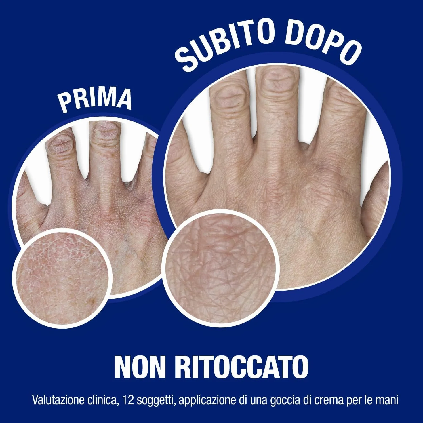 Neutrogena Formula Norvegese Crema Mani Assorbimento Rapido, 150 ml