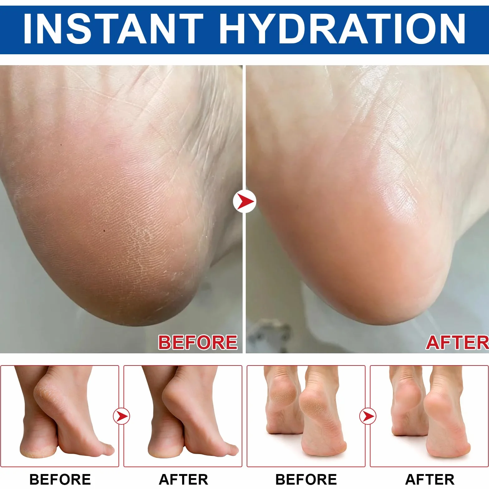 Crema all'urea al 60% per Piedi, Mani, Gomiti e Ginocchia - Riparazione Intensiva per Pelle Secca, Ruvida e Screpolata