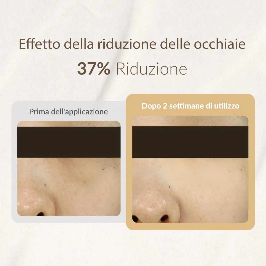 MIZON SNAIL REPAIR EYE CREAM (TUBE)