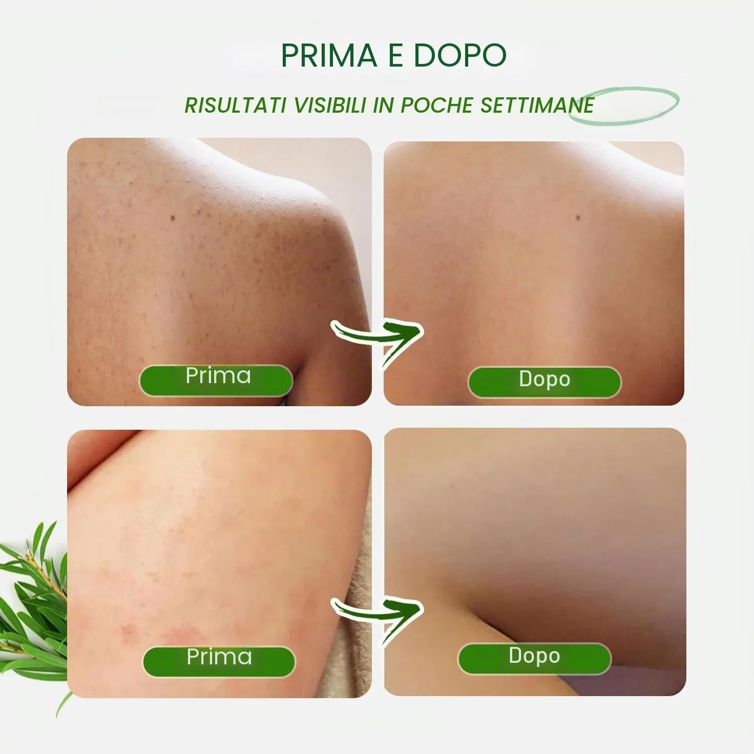 Tea Tree Body Wash, Gel Doccia Rinfrescante con Aloe, Olio di Cocco e Olio di Oliva, Uomo e Donna