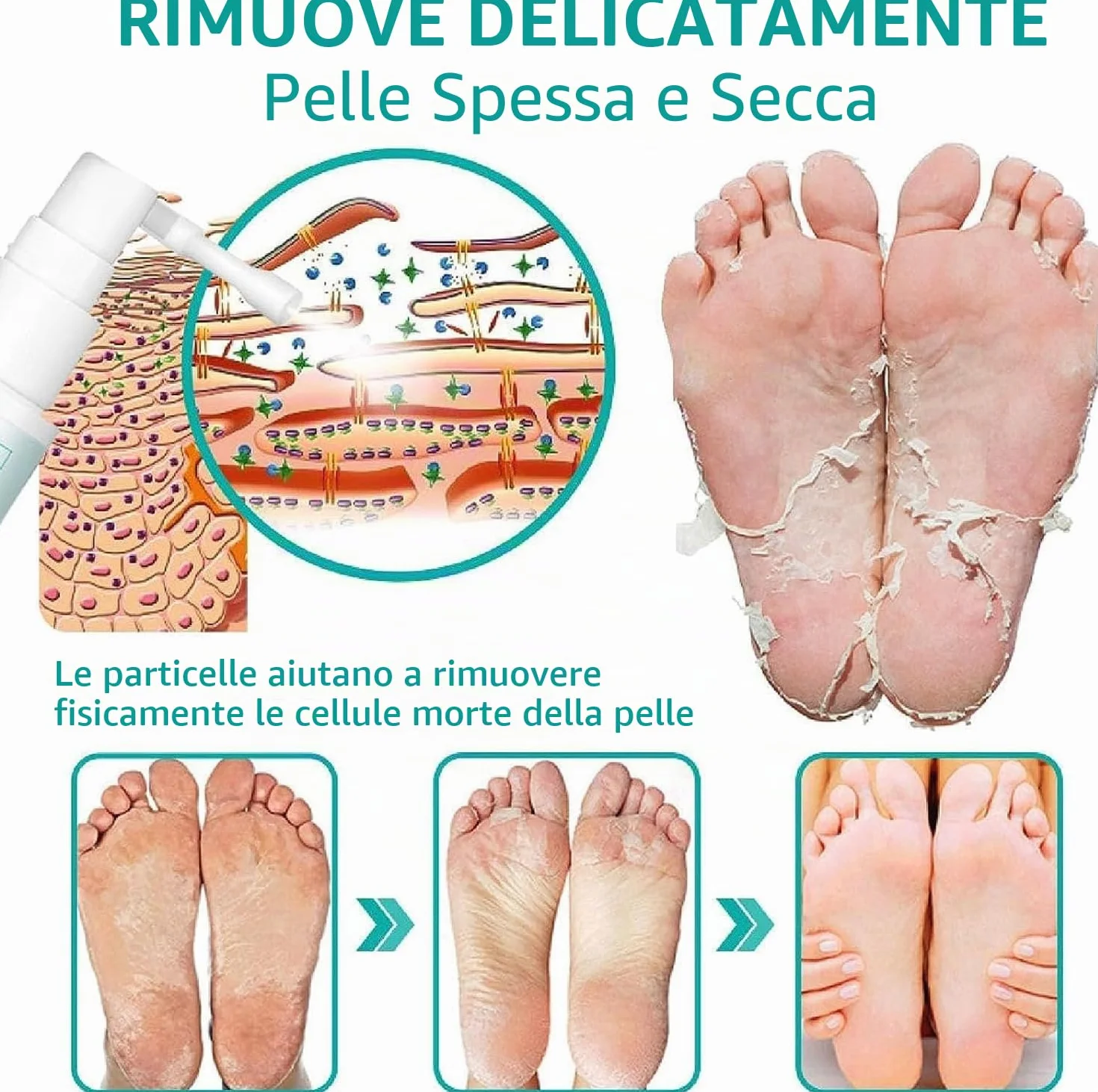 Spray extra forte per rimuovere i calli: spray rimuovi calli per piedi e tallone, olio spray per pelle morta
