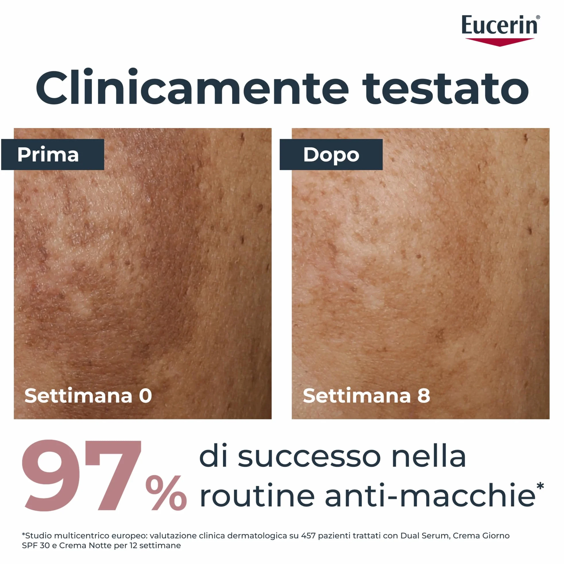 Eucerin Anti-Pigment Siero Viso Dual Serum 30 ml, Siero antimacchia viso concentrato per una pelle uniforme e levigata, Formula con Acido Ialuronico e Thiamidol per tutti i tipi di pelle