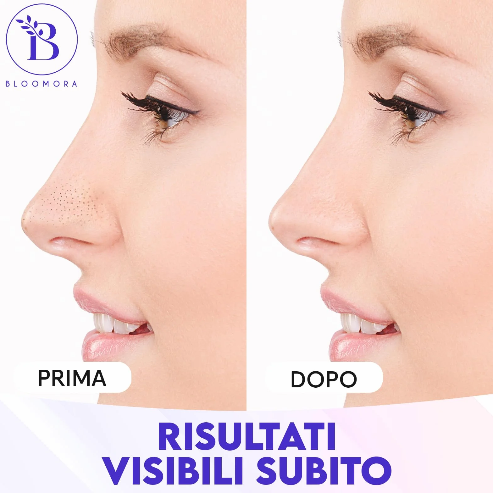 Cerotti Punti Neri Naso – Cerotti per Punti Neri con Amamelide e Niacinamide – Pore Strips per Rimuovere Bianchi e Liberare i Pori (24 Pezzi)