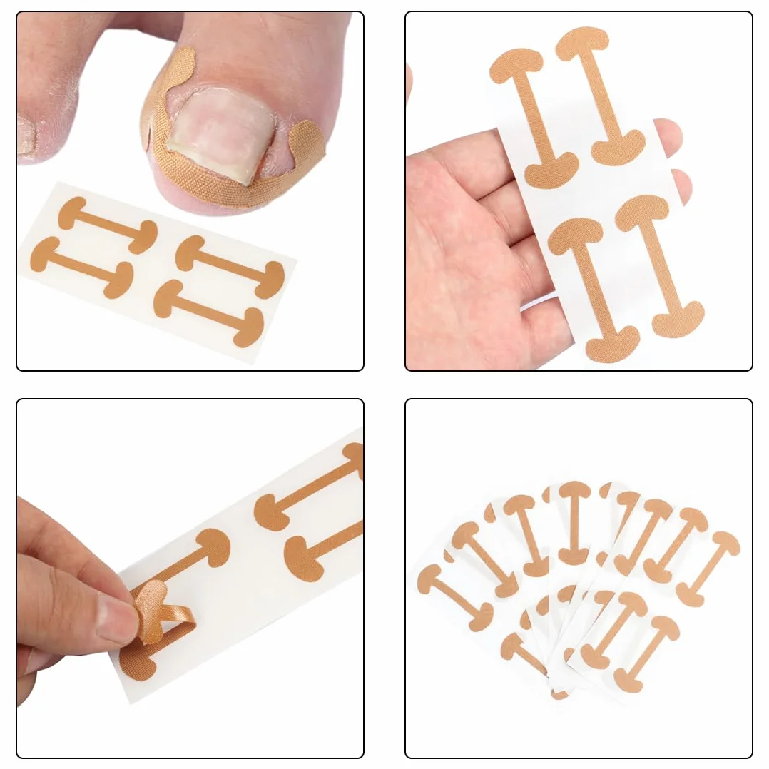 Cerotti per Unghie Incarnite, Strumenti per Pedicure, Foglio Correttore, 50 Pezzi