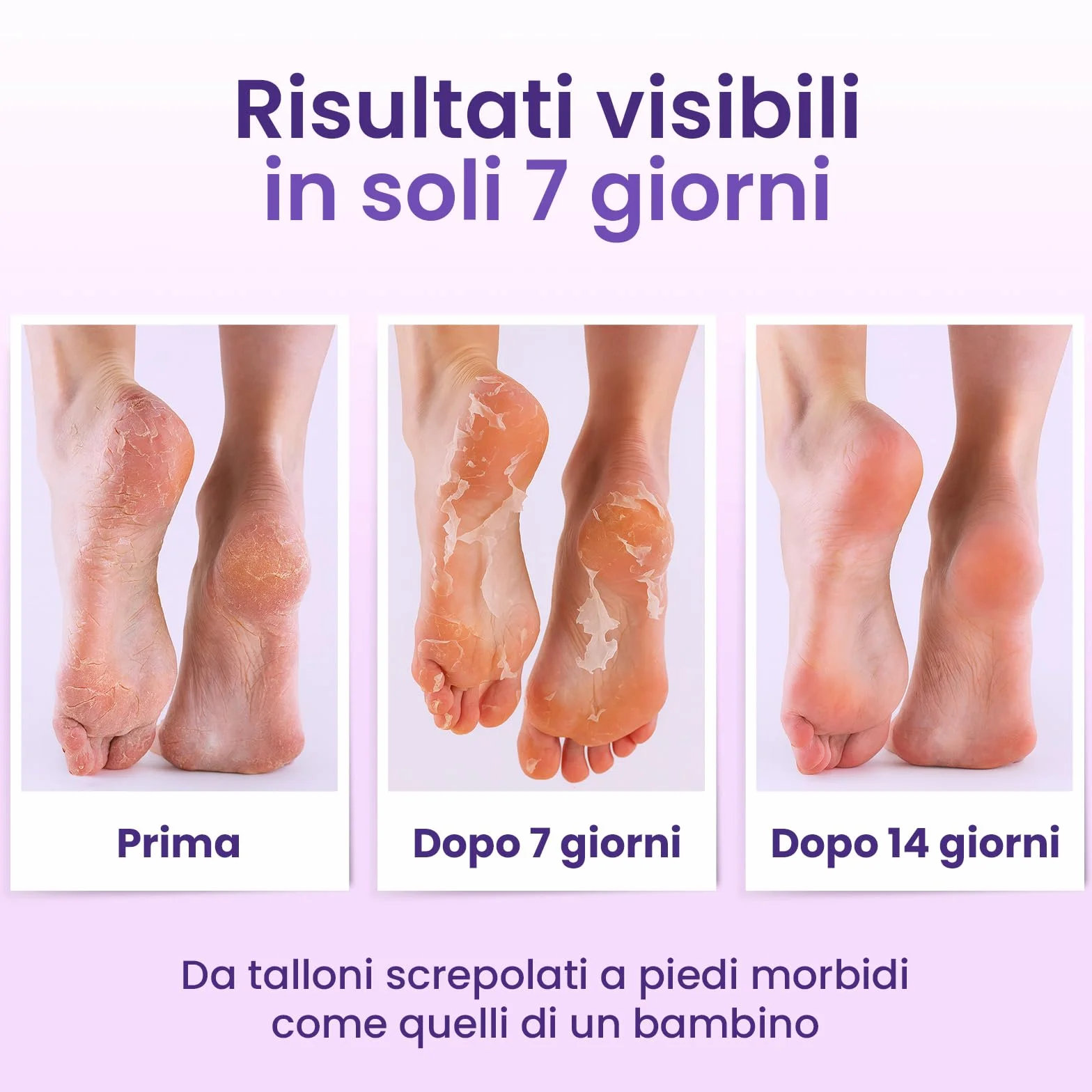 Maschera Piedi Esfoliante (6 Paia), Trattamento per Talloni Screpolati con Lavanda e Burro di Karité, Peeling Piedi Idratante per Uomo e Donna, Calzini Esfolianti Taglia Unica