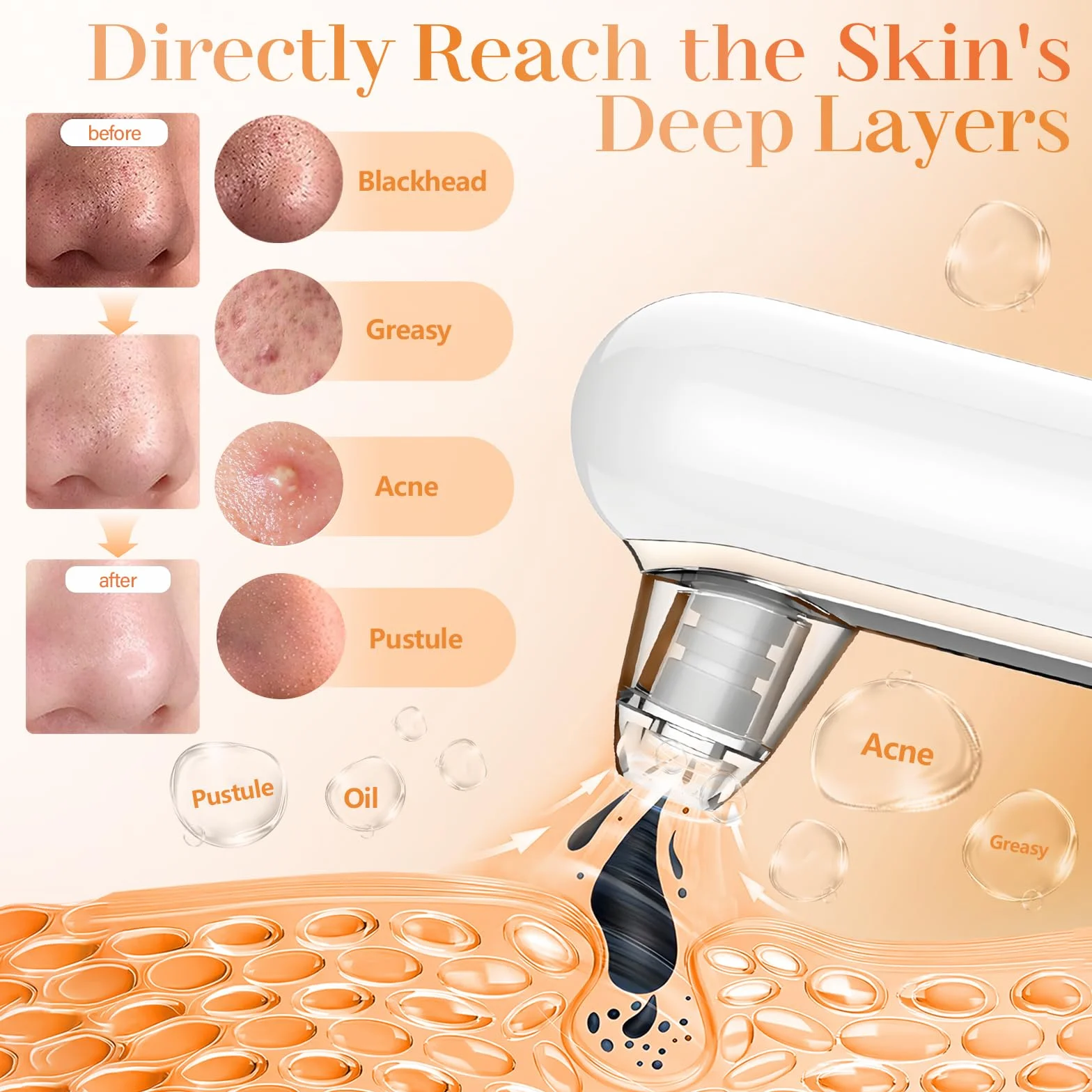 Aspiratore Punti Neri Professionale Elettrico, Rimozione Comedoni con 4 Testine e 4 Modalità, Blackhead Remover Vacuum