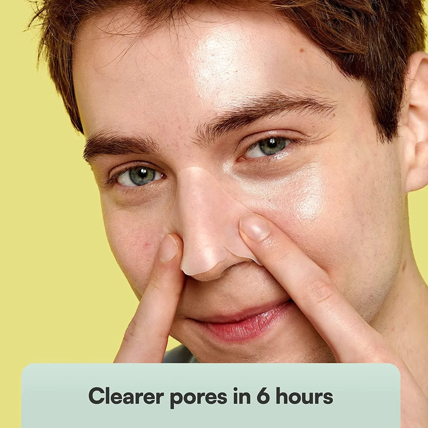SKIN CHOICE Nose Pore Strips - Strisce idrocolloidali per la pulizia profonda per liberare e restringere i pori, assorbire il sebo, acne e punti neri Vegan (5 unità)