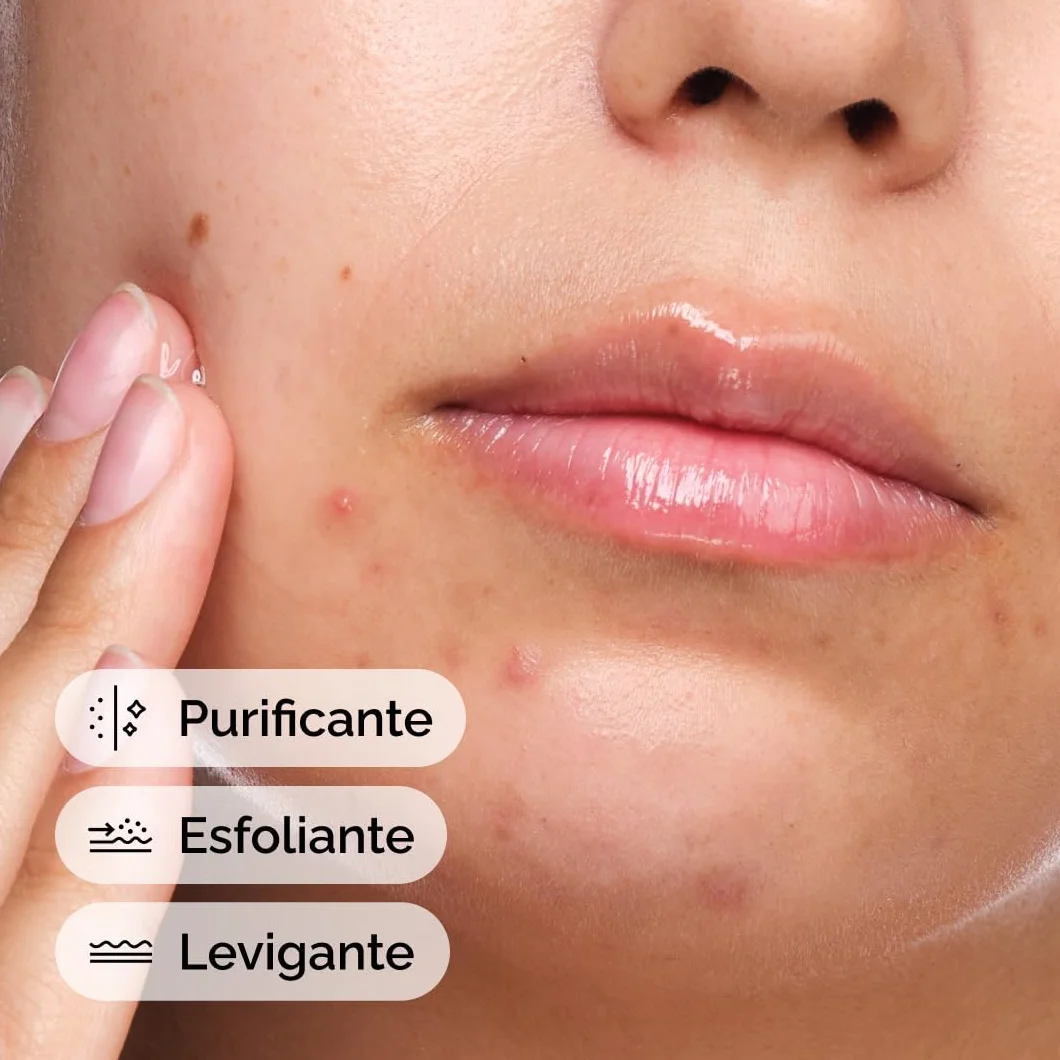 The Ordinary Salicylic Acid 2% Solution 30ml