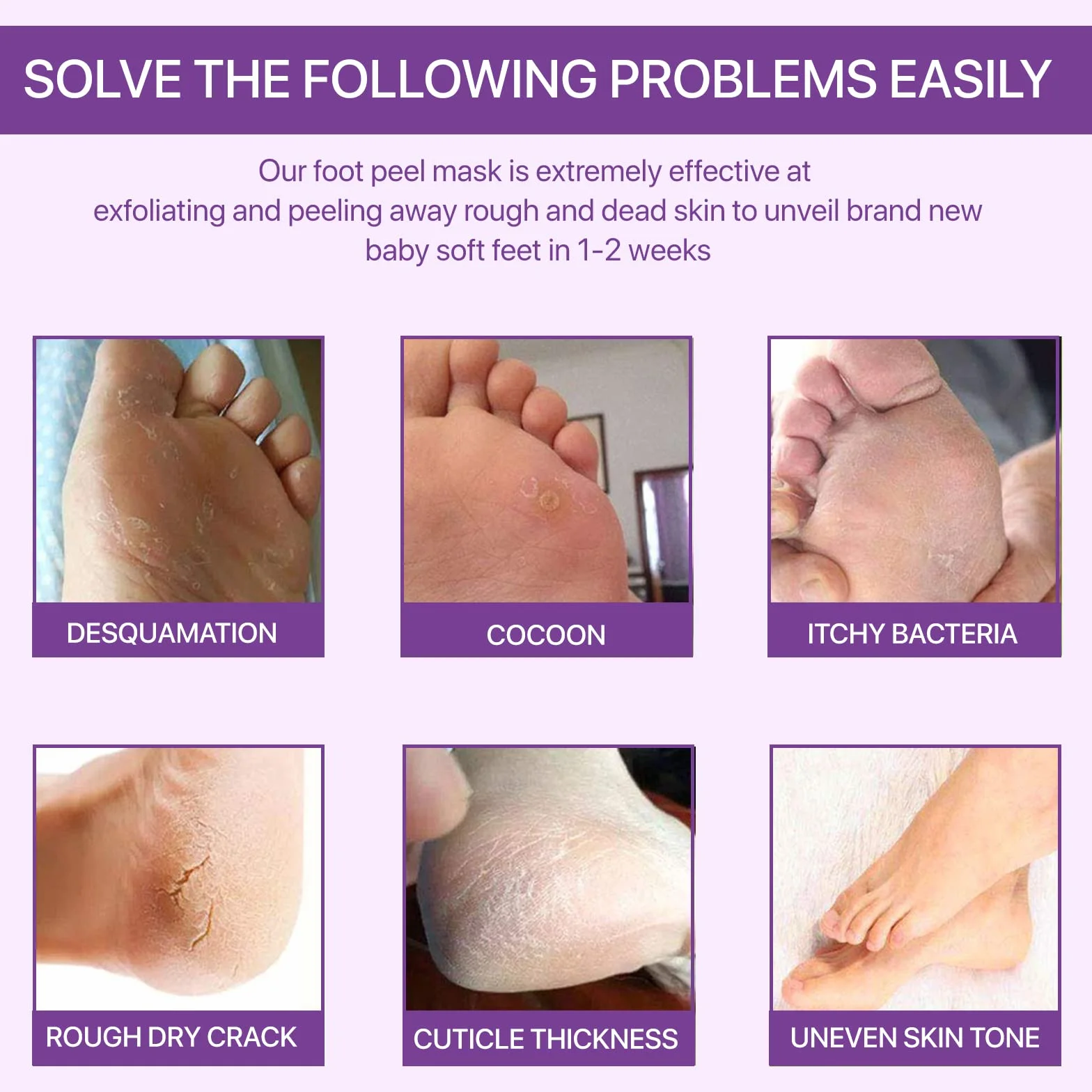 Sefudun - Esfoliante E Idratante Maschera Peeling Piedi, 3 Pacchetto, 40 g