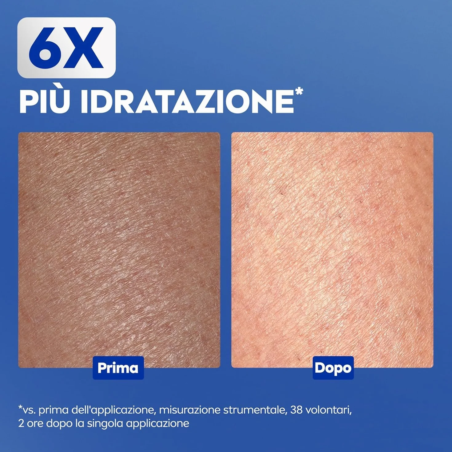 NIVEA Repair & Care Urea 400 ml, Crema corpo idratante pelle secca, molto secca, ruvida e screpolata, Crema multiuso per corpo, viso e mani nutriente 72H con 15% Glicerina e Urea