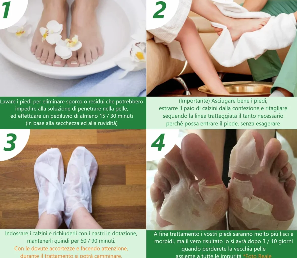 Pedimask Maschera Piedi Esfoliante Idratante UltraSTRONG IT - Rimuovere Calli Pelle Morta - Pulizia Profonda - Dermatologicamente Testato (ALOE)