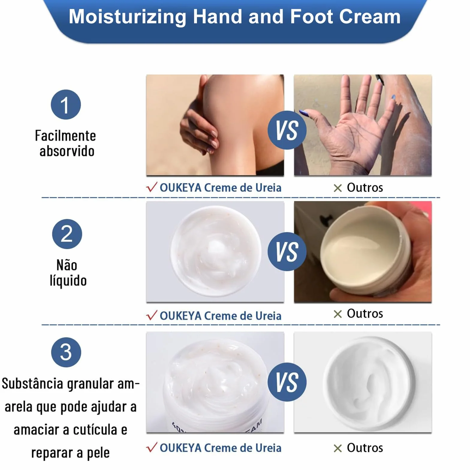 Crema Piedi Urea 40% 150g Trattamento Per Talloni Screpolati Ammorbidimento Dei Calli