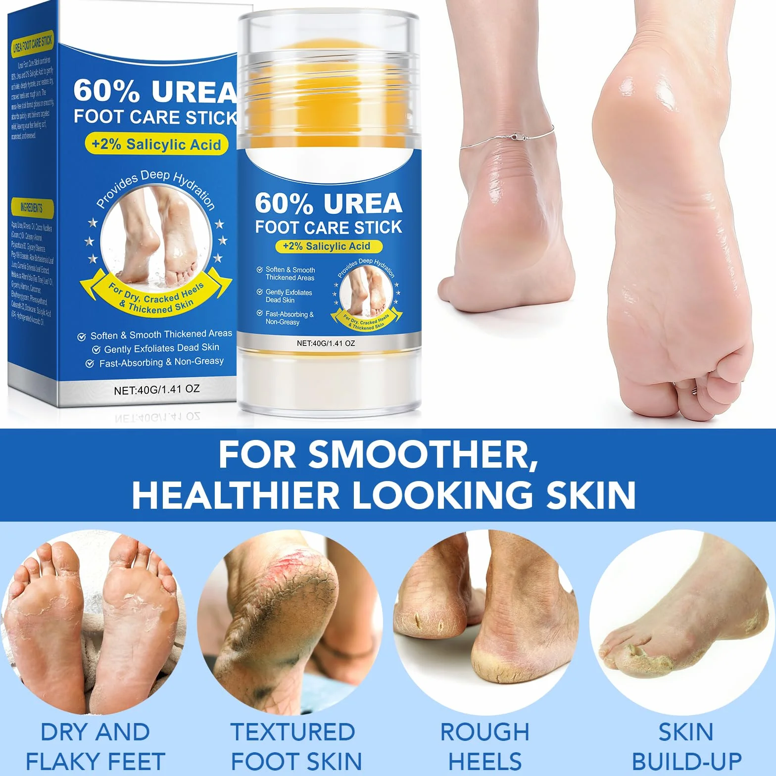 Crema Piedi Urea 60% 40g (2 Pezzi) Idratazione Profonda Pelle Ruvida