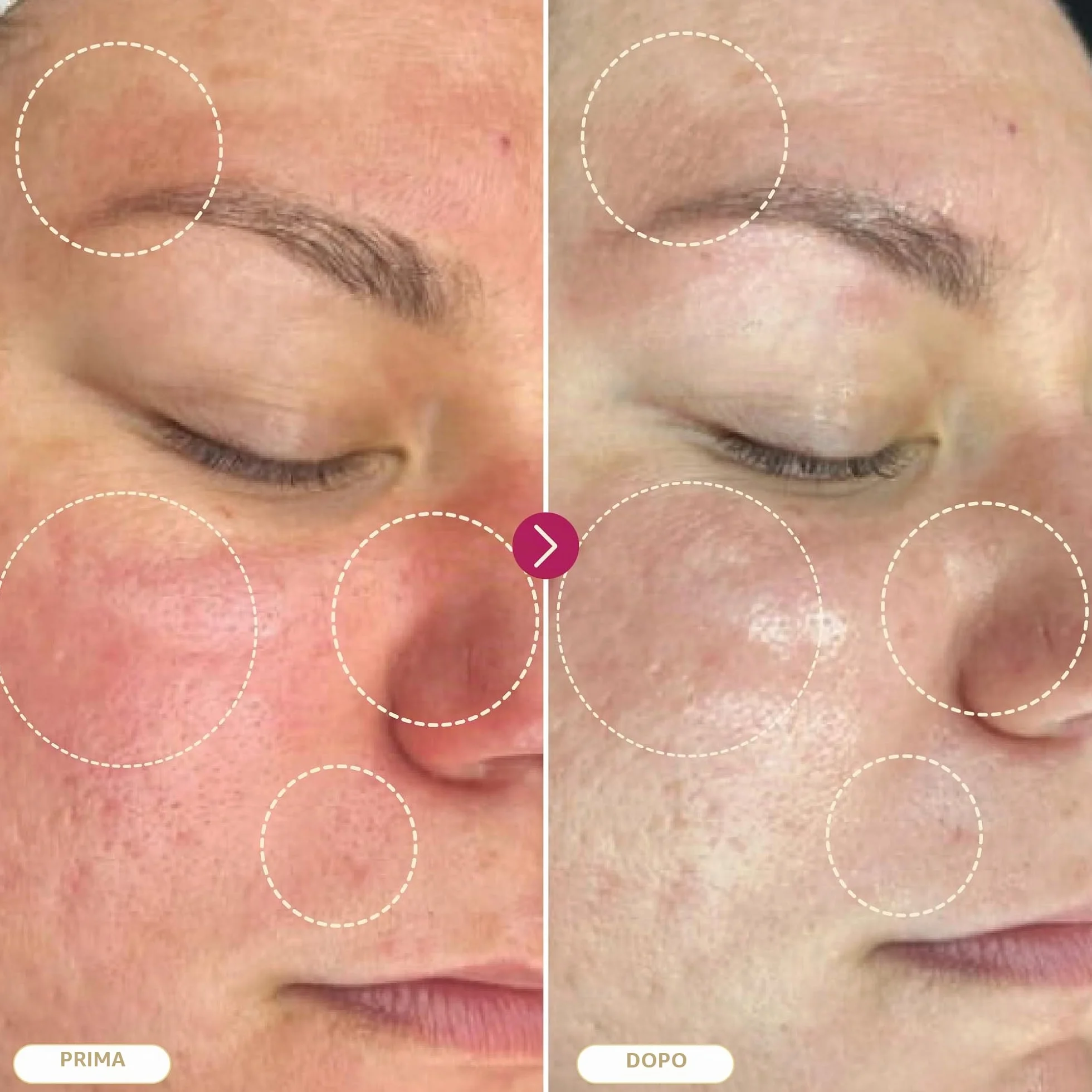 BASE LABORATORIES Spray acido ipocloroso, guarigione della pelle per ferite, soluzione spray per la cura delle ferite, eczema, tatuaggi e piercing | lavaggio delle ferite con soluzione salina