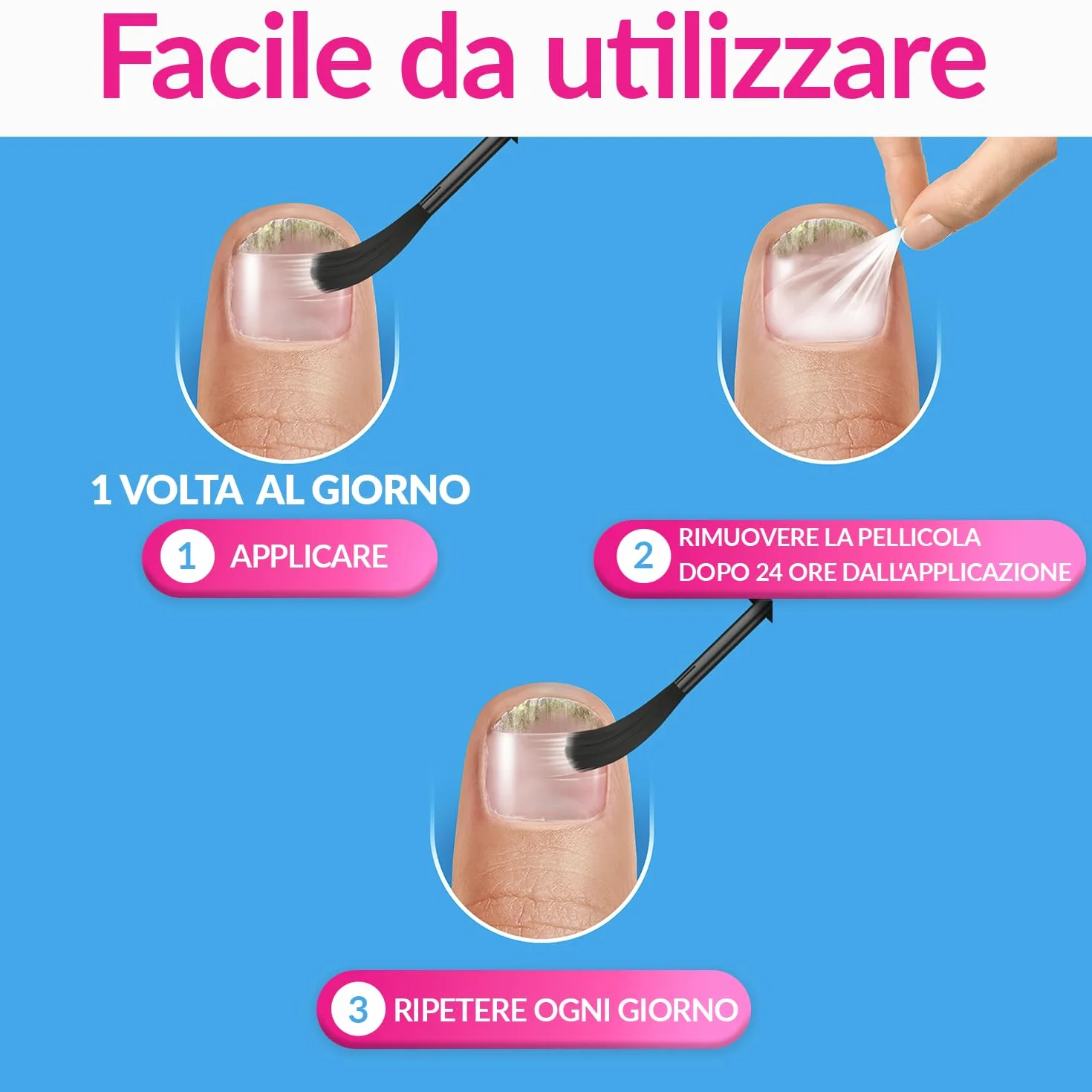 Excilor Micosi dell’unghia Forte, Trattamento Micosi Unghia Attivo, 30 ml