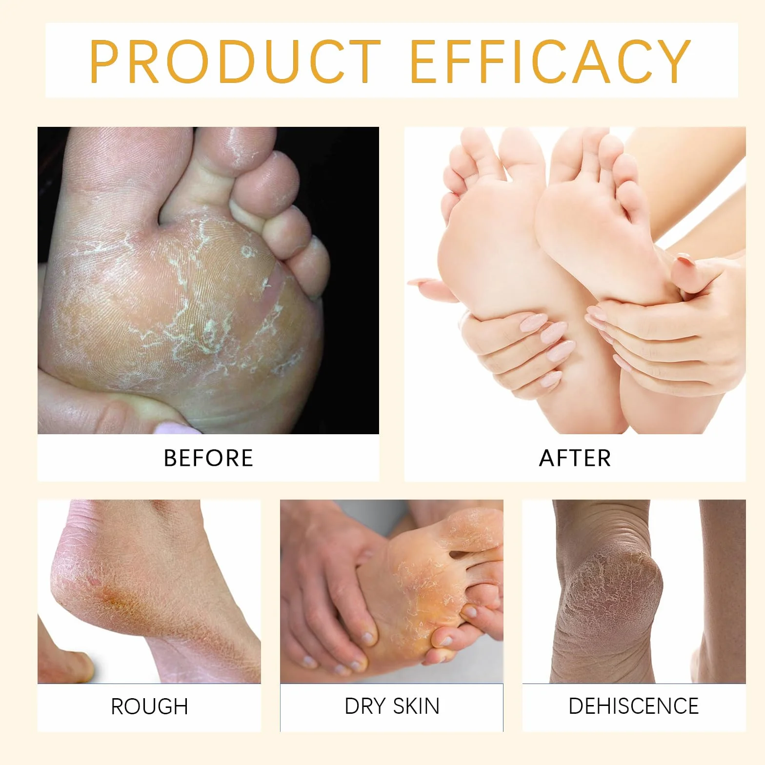 Crema Piedi Urea 60% 2 Pezzi Talloni Screpolati Calli