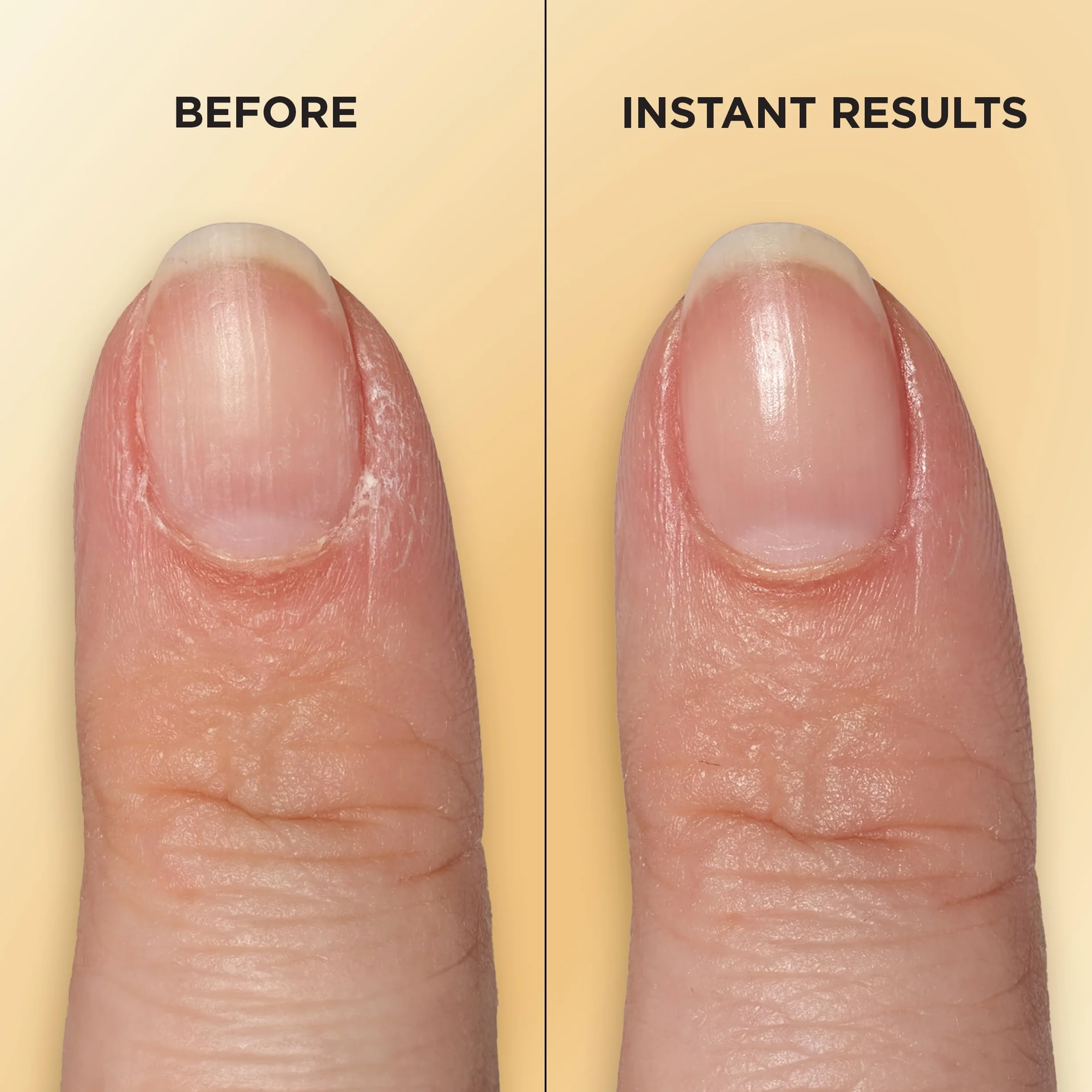 Sally Hansen Vitamin E Nail & Cuticle Oil Pen, Trattamento per unghie, Formato Penna da viaggio per cuticole