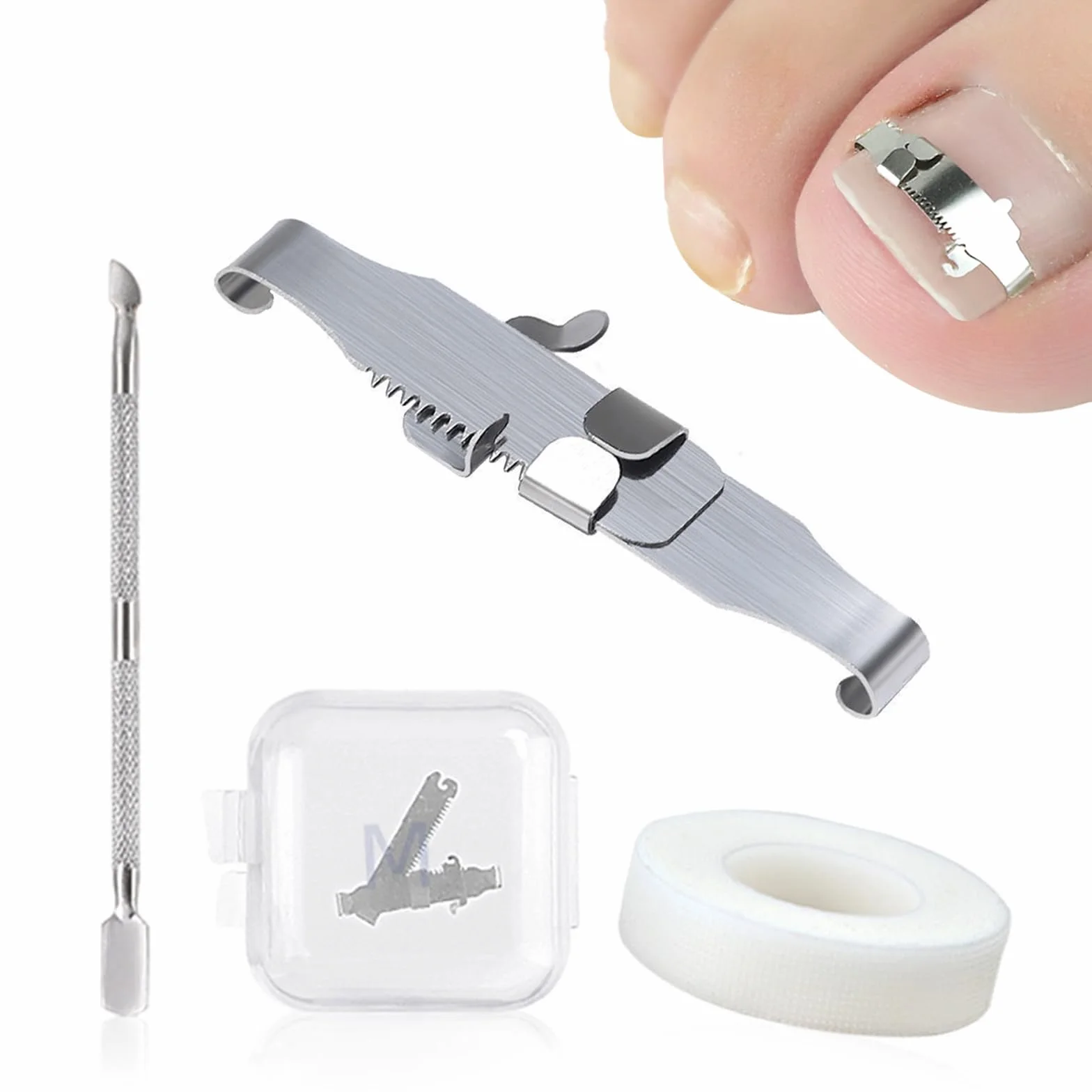 2Pcs Strumenti Per Unghie Incarnite, Fibbia Per Correzione Delle Unghie Dei Piedi Incarnite e Trattamento Della Paronichia, In Acciaio Inox Chirurgico