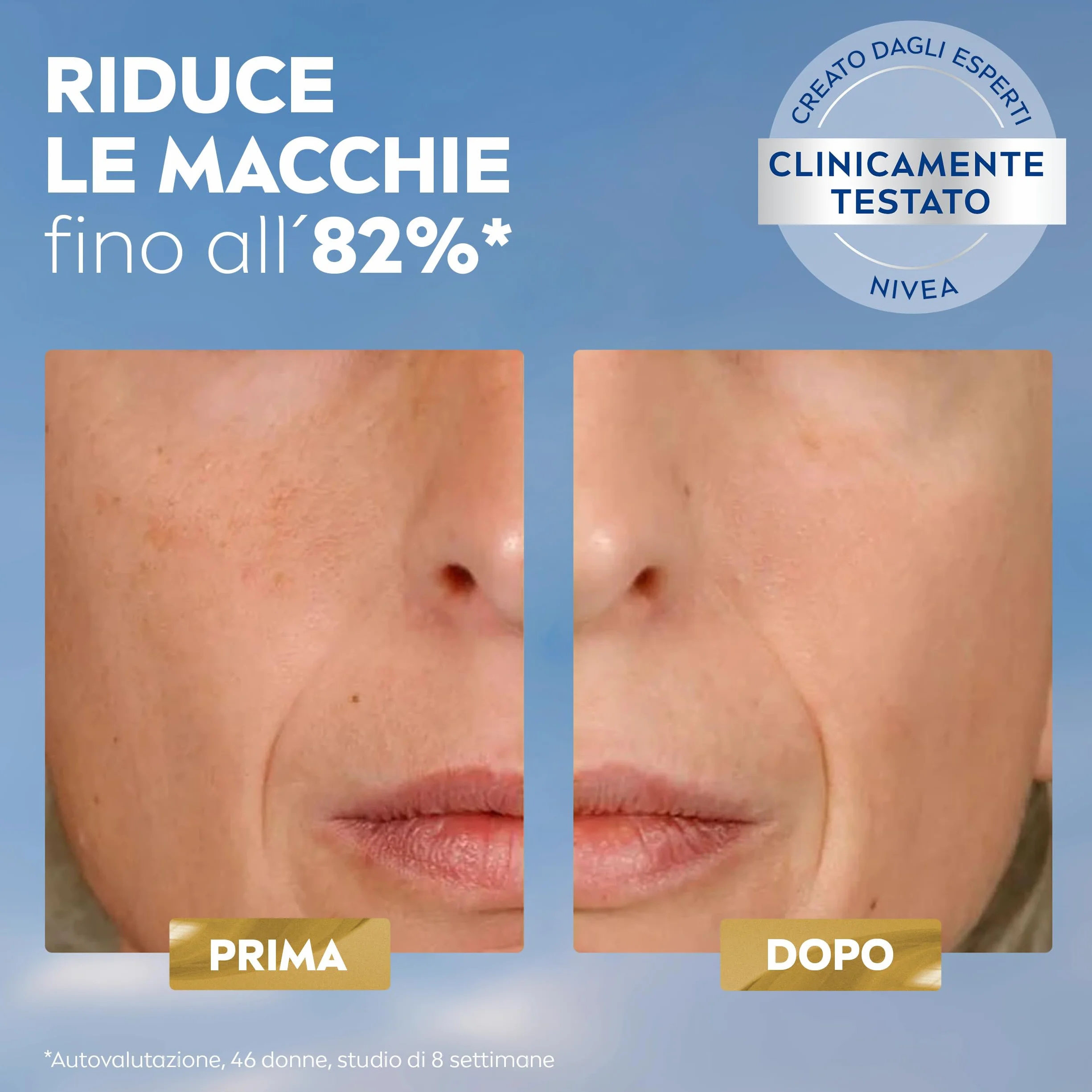 NIVEA Luminous630 Siero Viso Anti-Macchie Trattamento Avanzato 30 ml, Siero antimacchia viso per una pelle luminosa, Siero viso Acido Ialuronico e Thiamidol brevettato per tutti i tipi di macchie