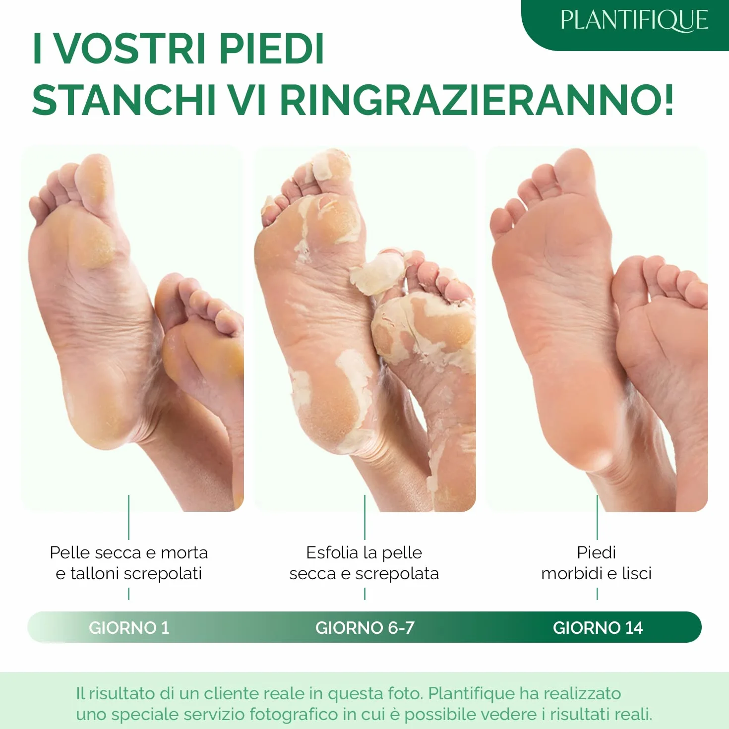 PLANTIFIQUE Maschera Piedi Esfoliante Trattamento Calli Duroni Scrub Piedi Peeling Forte 2 Paia
