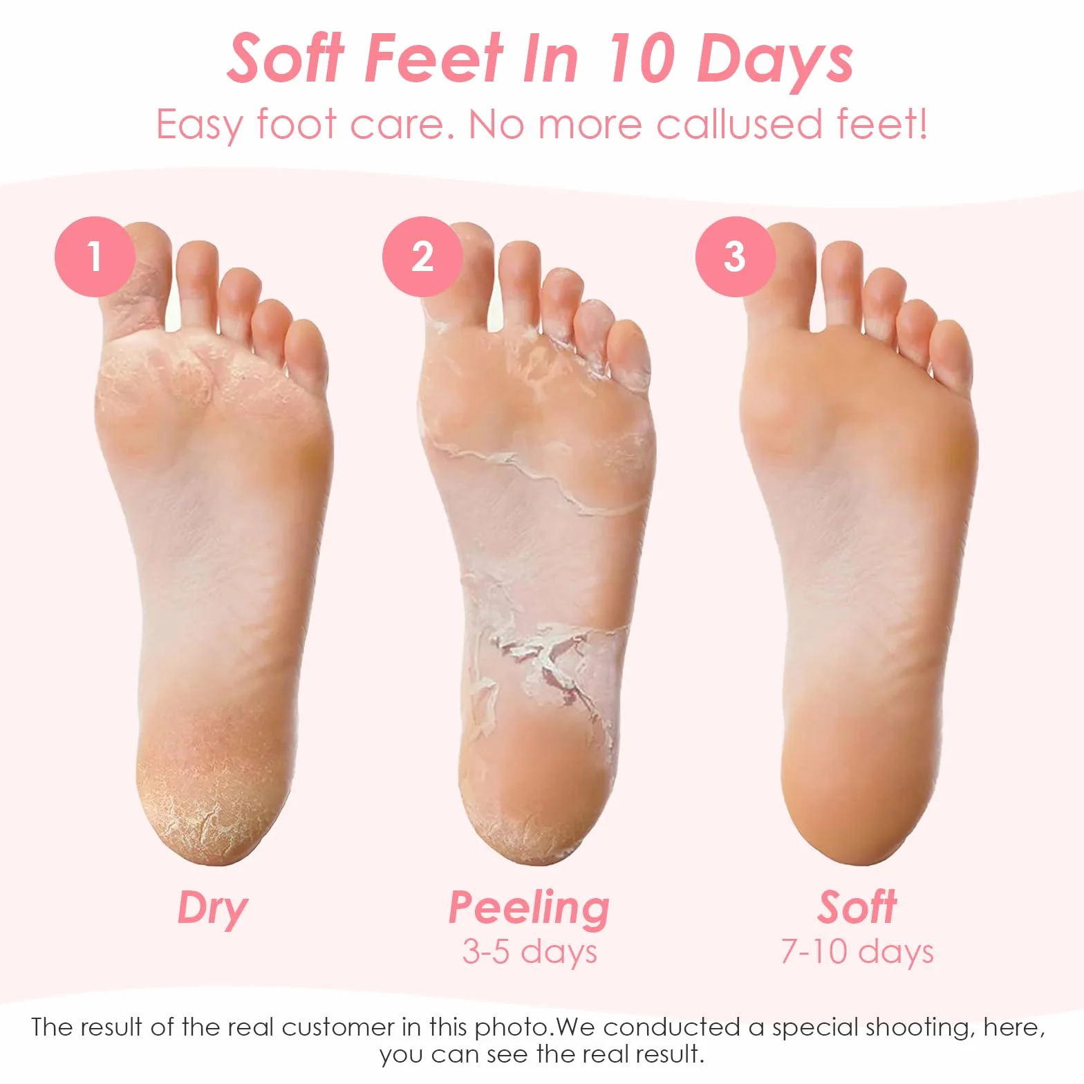 2 Paia Maschera Piedi Esfoliante,Maschera per Piedi Efficace Cura dei Piedi i Scrub Piedi,Maschera Esfoliante Piedi per Donne e Uomini,Rimuove Pelle Morta e Secca（ Fragola Pesca）