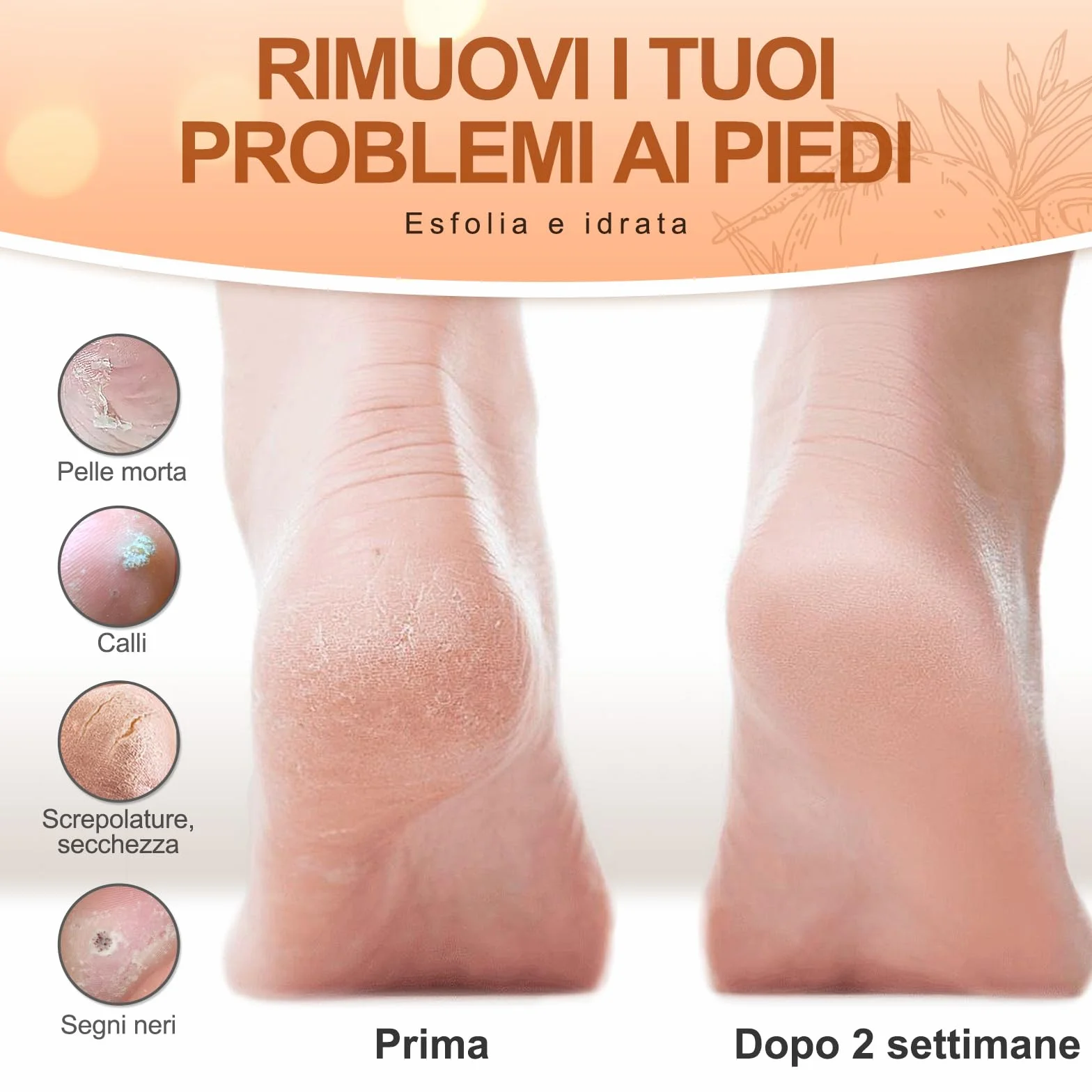 LA.PERSONAL Maschere Piedi 5 paia Peeling Piedi con Raspa Piedi e Calzini, Maschera Esfoliante Piede, Lisci e Morbidi, Maschere Piede Idratante Per Tallone Secchi Screpolati, Pelle morta e Calli