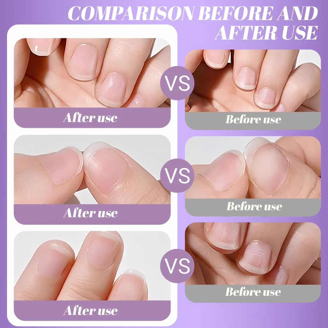 3-in-1 Penna per l'olio per cuticole, penna per olio per le cuticole pusher con punta in ceramica, penna per rimuovere cuticole idratante e illuminante, per unghie secche e stressate