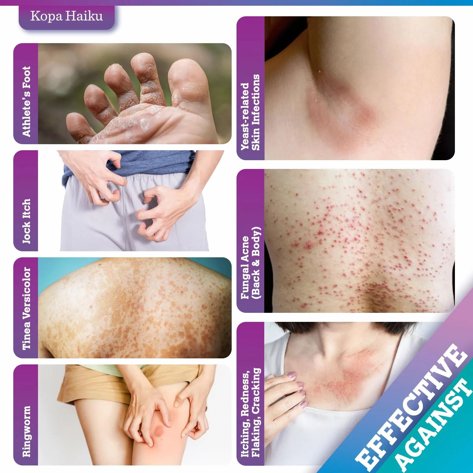 Crema Antimicotica Piedi Pelle Antiprurito: Trattamento Topico per Piedi, Inguine, Ascelle e Pieghe Cutanee