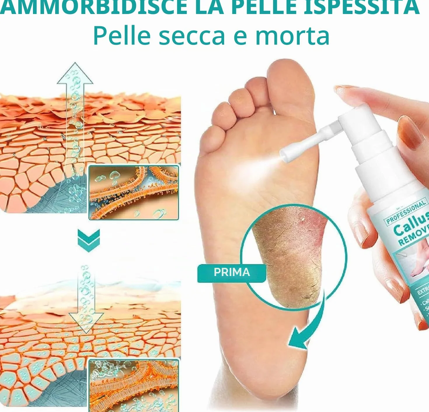 Spray extra forte per rimuovere i calli: spray rimuovi calli per piedi e tallone, olio spray per pelle morta