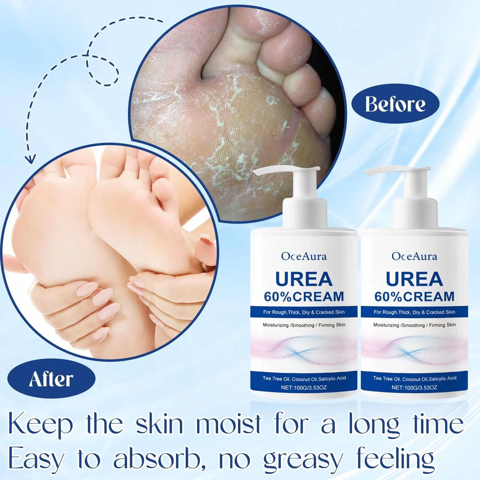 Crema Urea 2PCS, Urea Piedi, Piedi Arricchita con, Crema piedi secchi screpolati, per Mani, Talloni, Gomiti, Unghie e Ginocchia