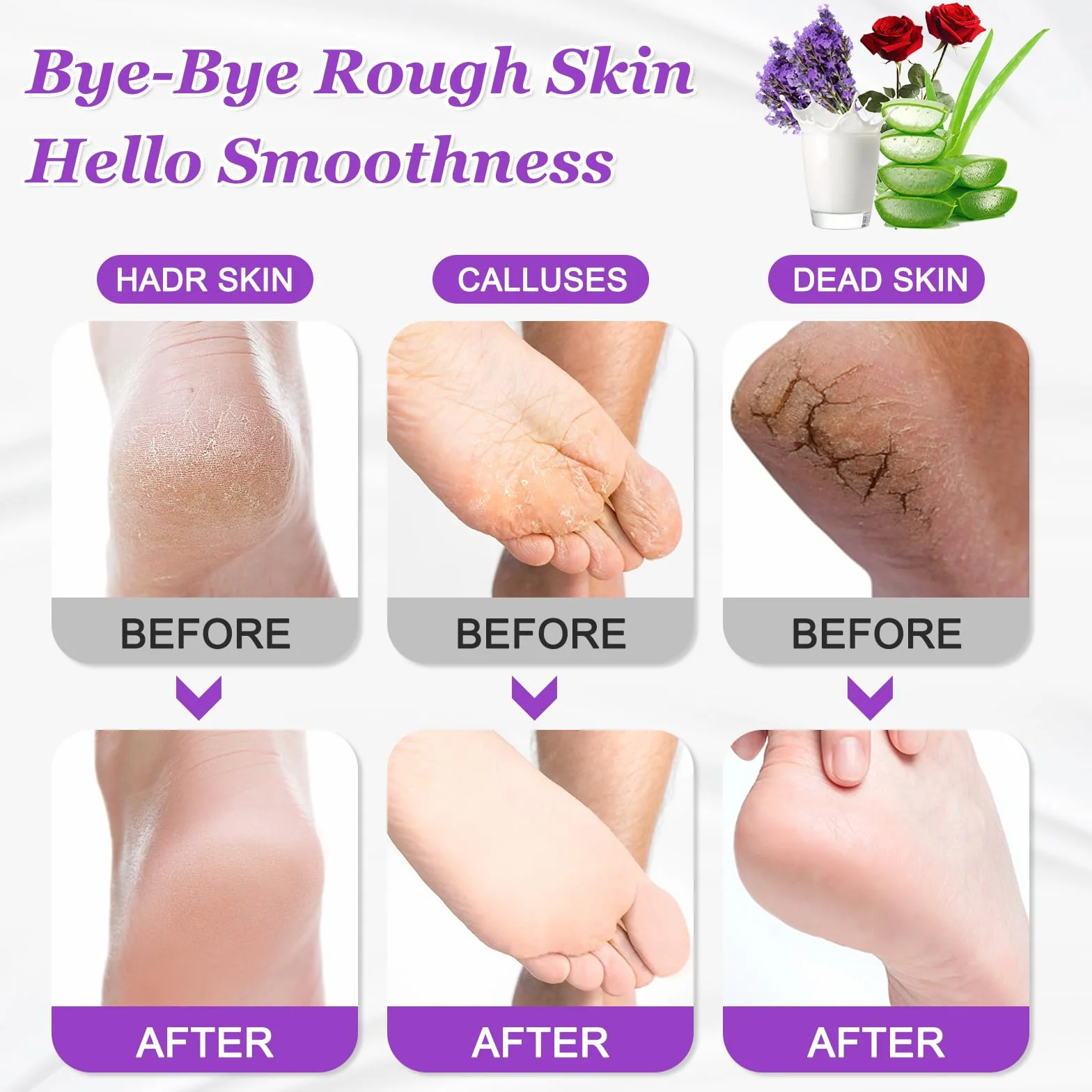 5 Paia Maschera Piedi Esfoliante, Calzini Idratanti per Piedi, Foot Peel Mask per Calli, Pelle Morta e Talloni Screpolati, Lavanda Latte di Capra Rosa Aloe Sbiancamento Foot Mask per Donne e Uomini