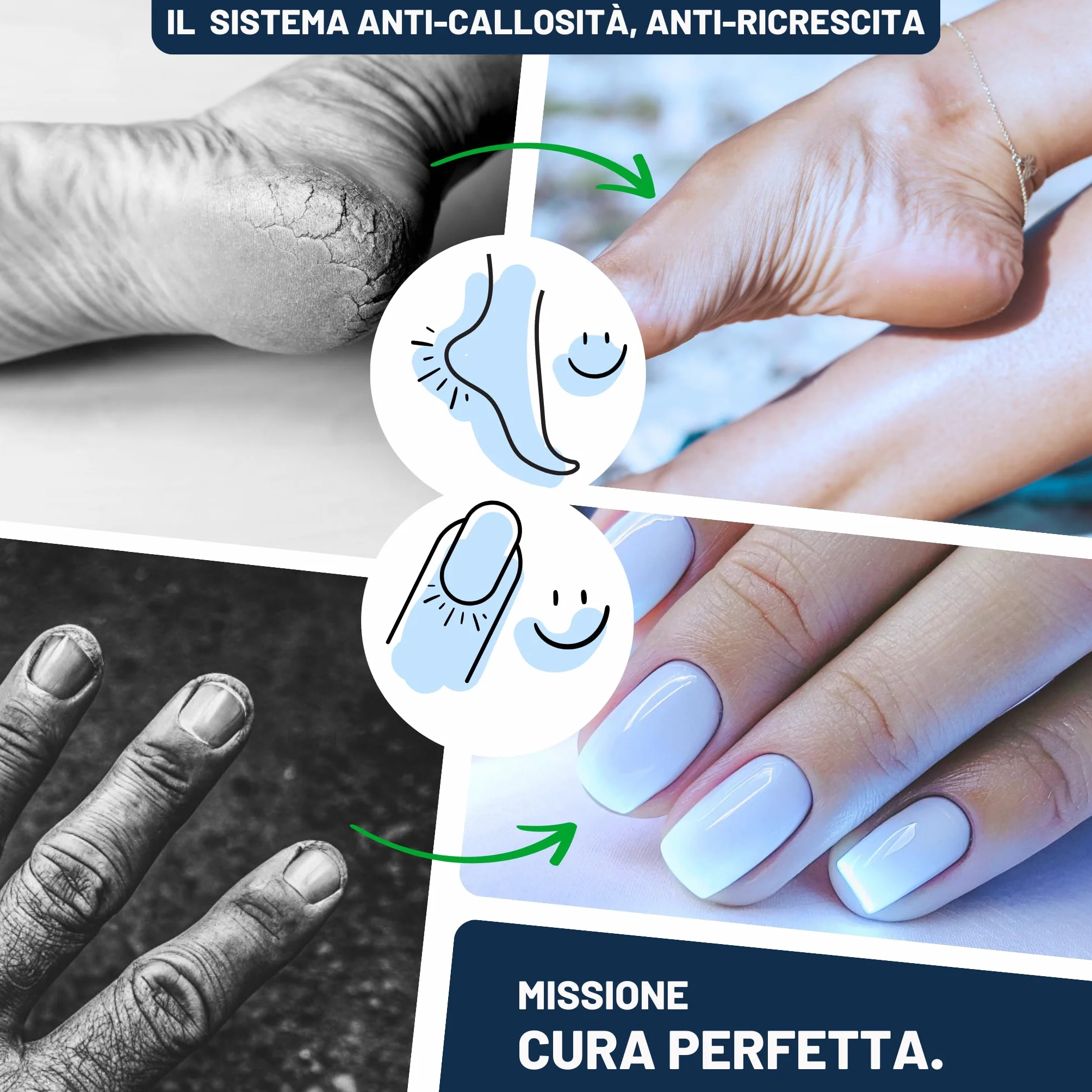 Mr. Fuss Levacalli soluzione attiva n° 4 500 ml calli piedi rimozione pedicure cheratolitico piedi