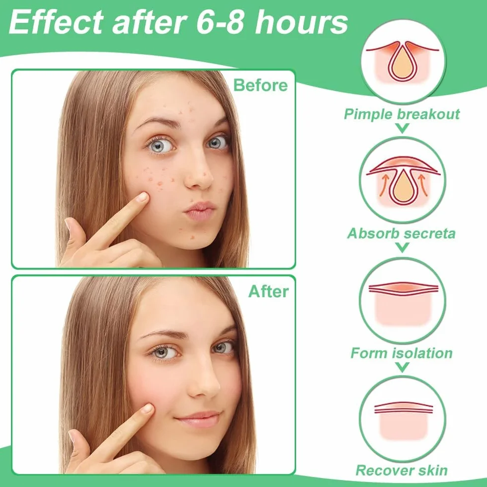 300 Pezzi Patch Brufoli Cerotti Pimple Patch Acne Invisibili Idrocolloide Cerotti Per Brufoli 2-In-1 Giorno e Notte Impermeabili e Traspiranti Pimple Patches