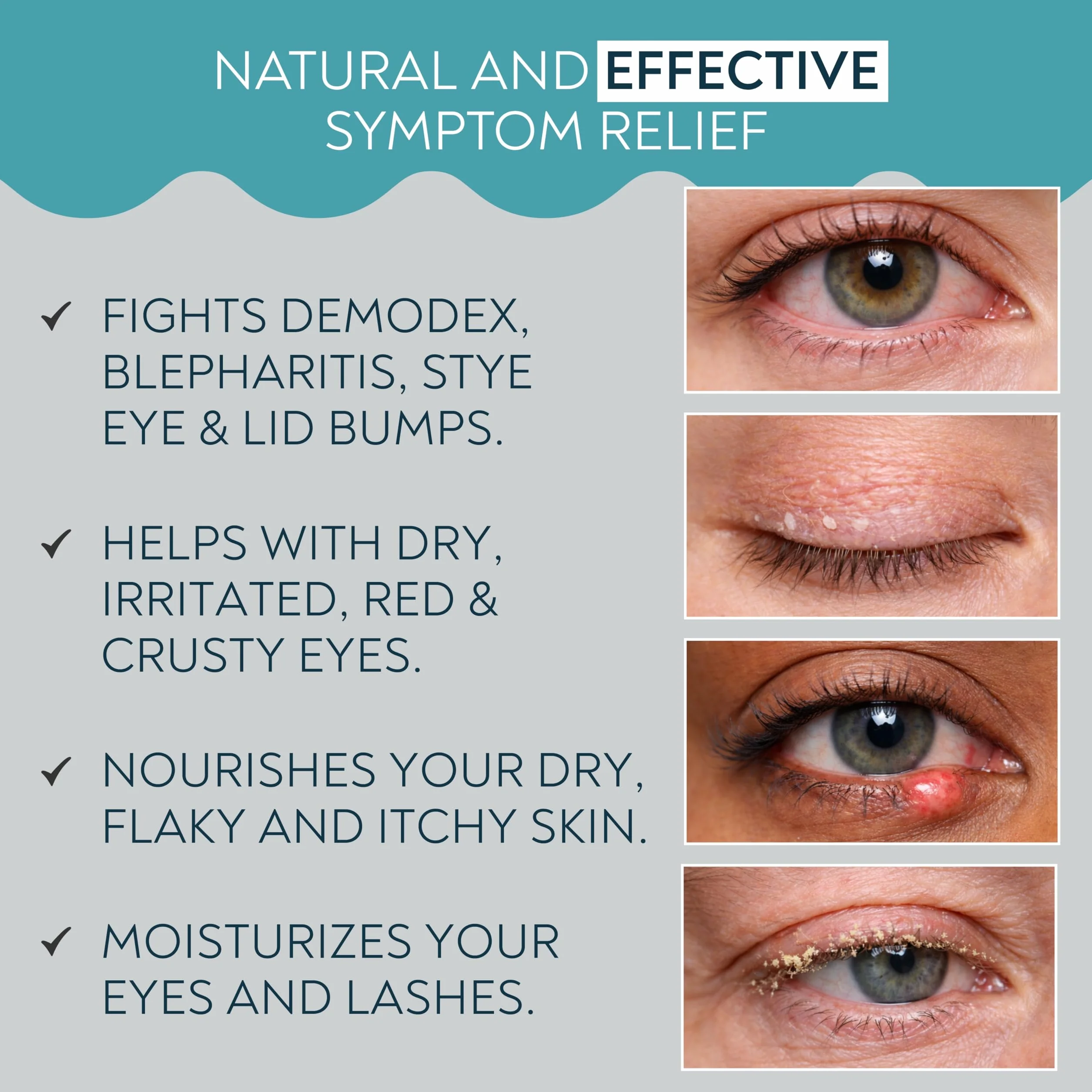NOVEHA Demodex, schiuma detergente per palpebre, formula extra forte, olio dell'albero del tè, lavaggio quotidiano per ciglia, demodex, MGD, occhi di porcile, irritazioni degli occhi e secchezza della