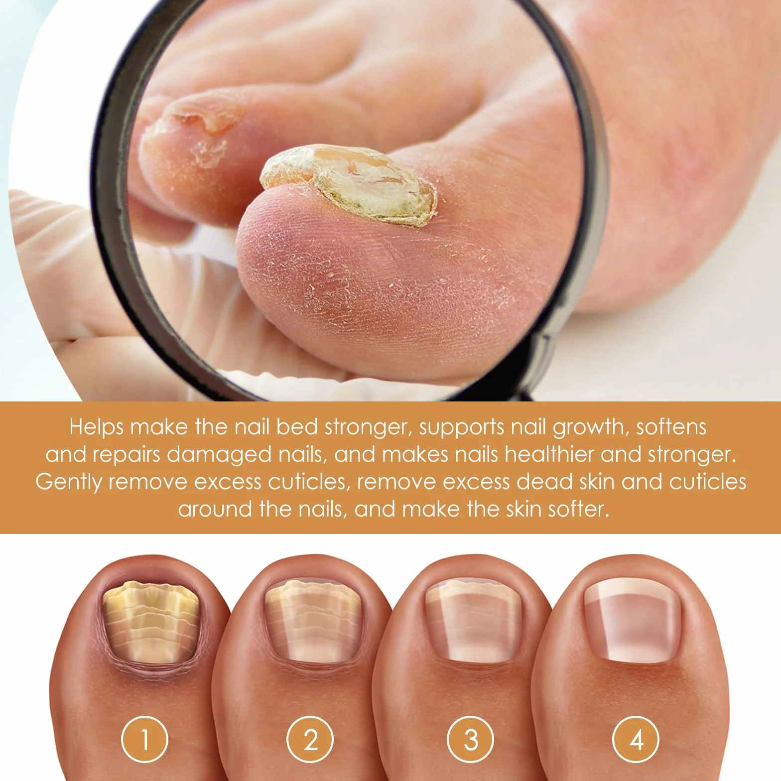 Cuticole unghie Riparazione Gel,Gel Ammorbidente e Cuticole Unghie,Ammorbidente e Cuticole Gel Unghie,Ammorbidente Professionale Cuticole,Gel Idratante per Unghie,Gel di Rimozione Cuticole