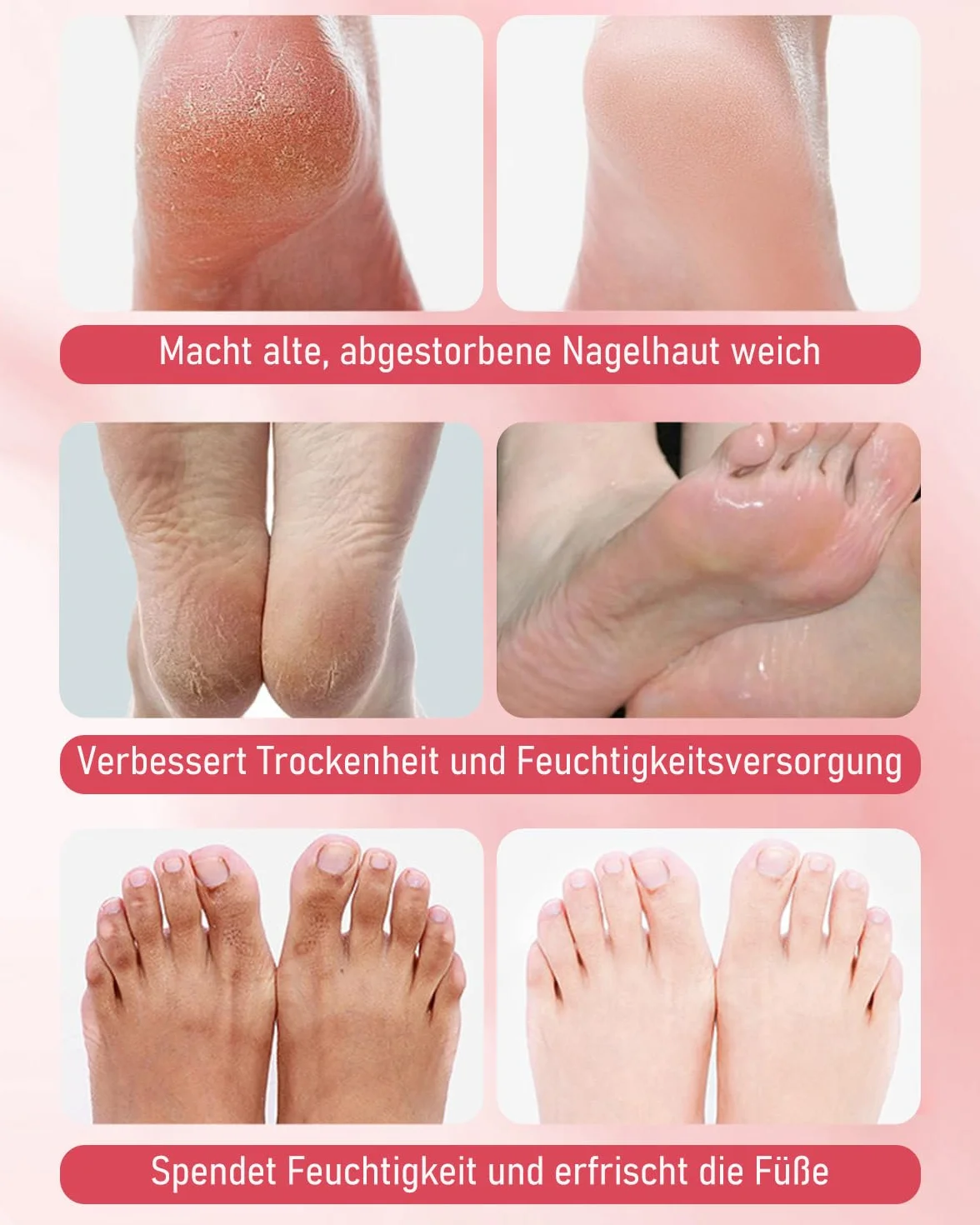 6 paia di maschere per piedi di pesca con niacinamide, idratanti e riparanti, peeling contro calli e pelle secca, maschera per piedi morbidi e delicati
