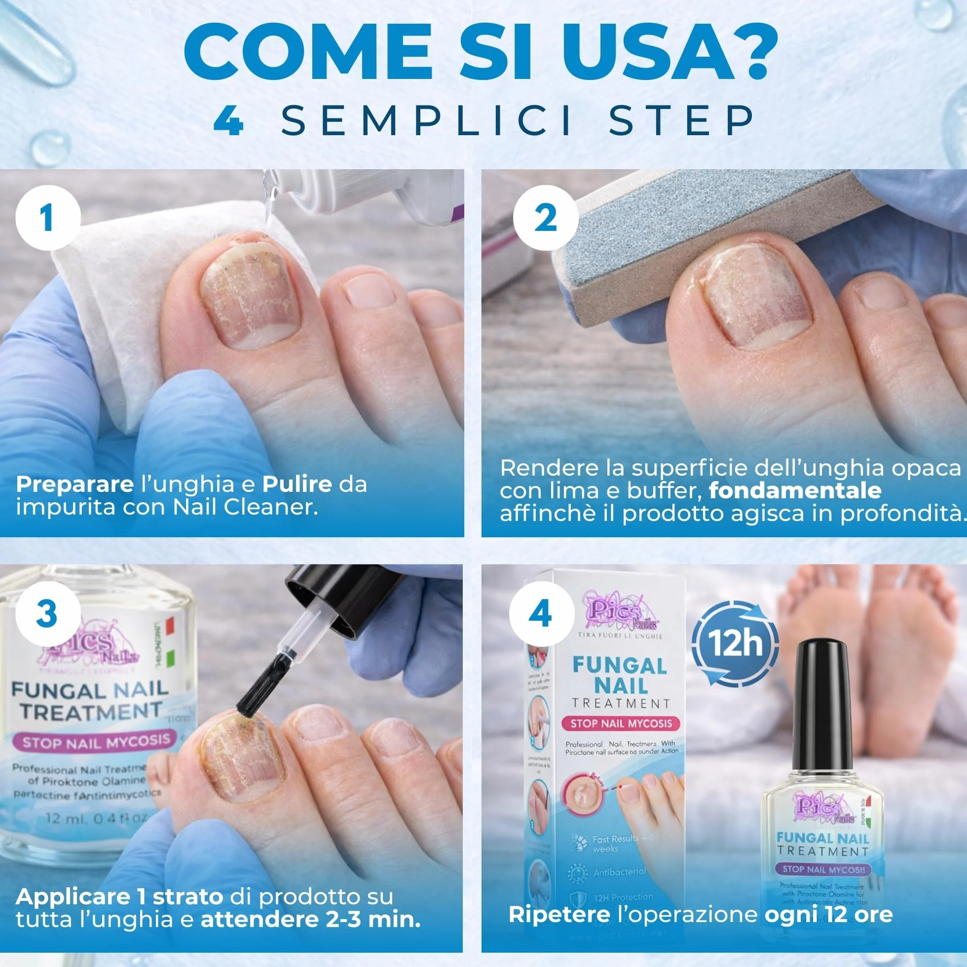 Antimicotico Micosi Unghie Piedi e Mani 12 ml - Trattamento Micosi del Piede e della Mano