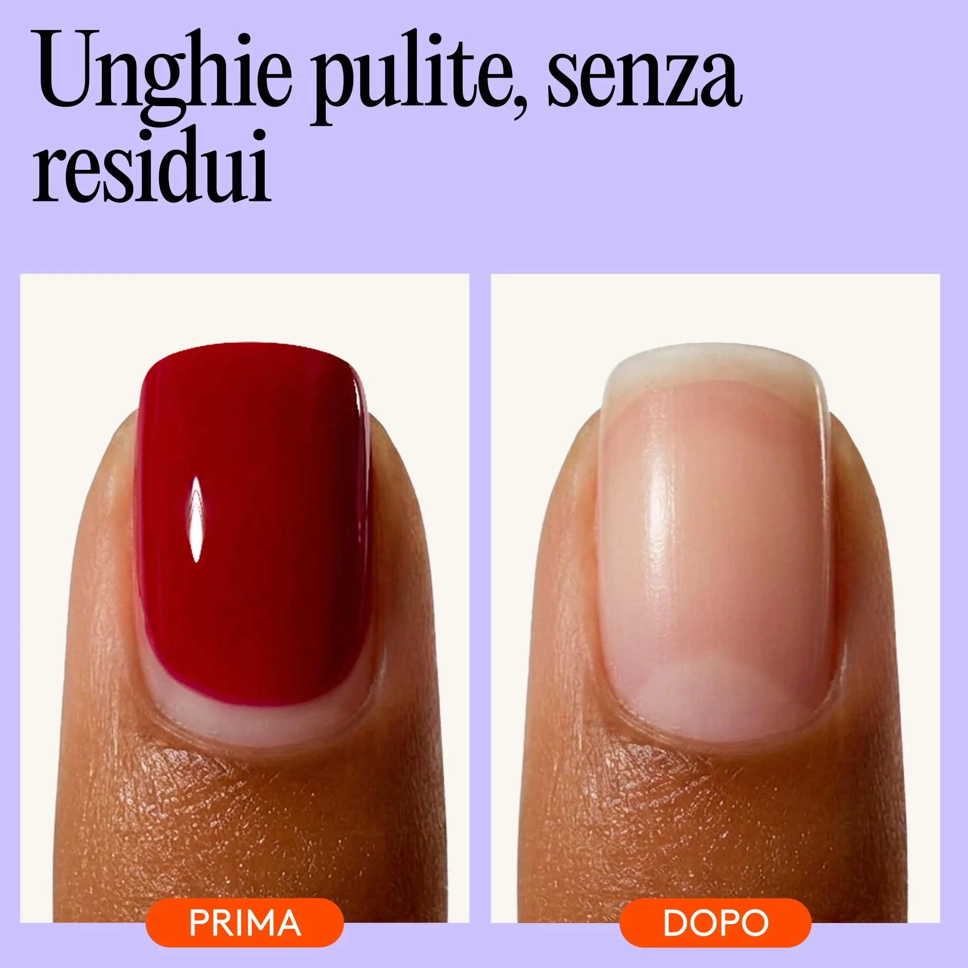 Mylee 100% Puro Acetone Solvente per Unghie per Smalti Gel UV/LED
