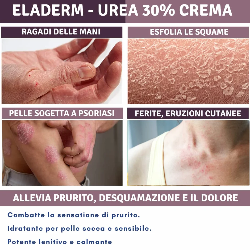 Crema Urea 30% 100ml per Eczemi Psoriasi Cheratosi Dermatite Talloni Screpolati Calli