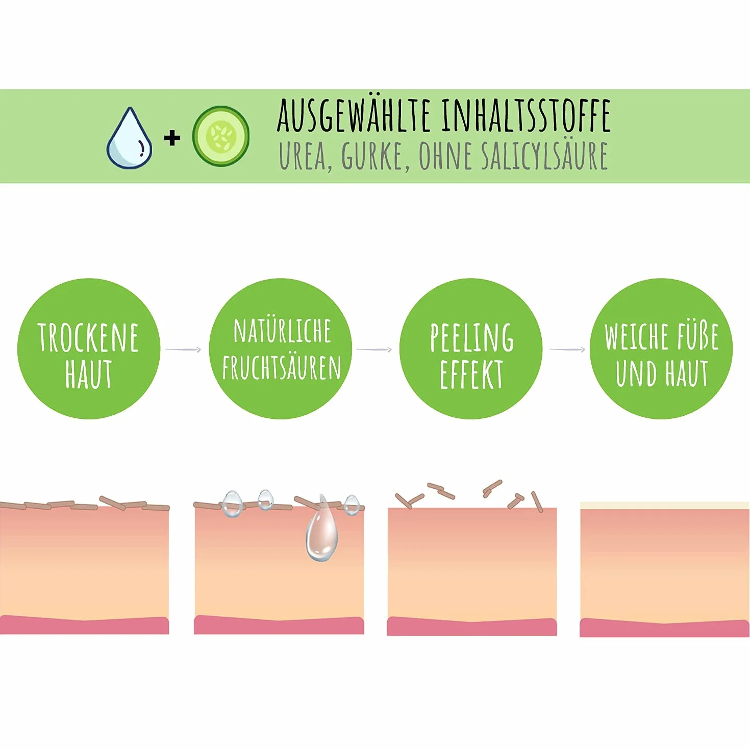 SUMMER FOOT Premium - Maschera per la rimozione di calli I dermatologicamente testata, istruzioni in lingua tedesca (Green Edition)