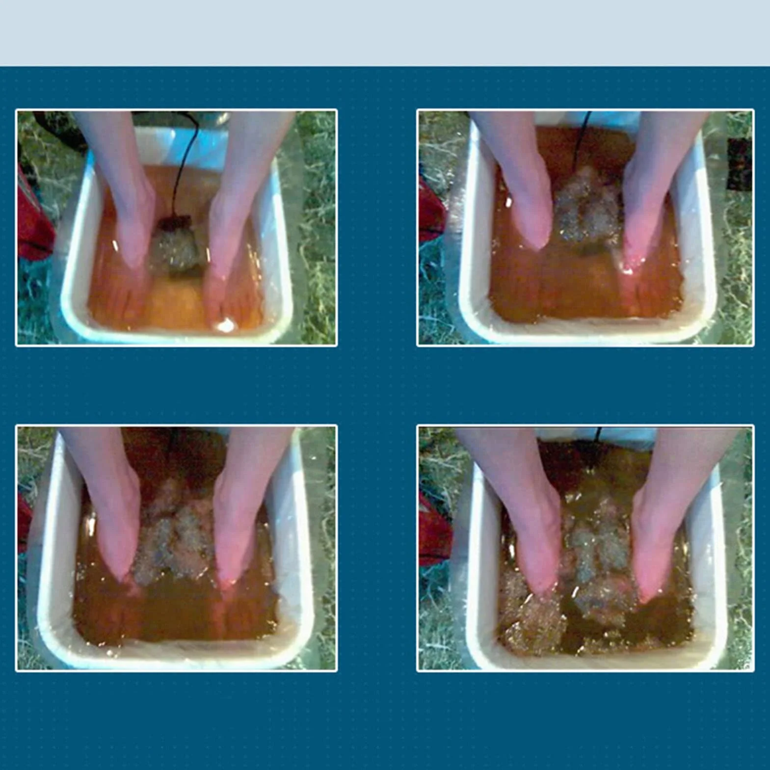 Array Disintossicante Per Pediluvio Ionico, Disintossicante Per Pediluvio Ionico 10 Array Tondo Accessorio Per La Pulizia in Acciaio Inossidabile Array di Disintossicazione del Piede Spa Array Per Cle
