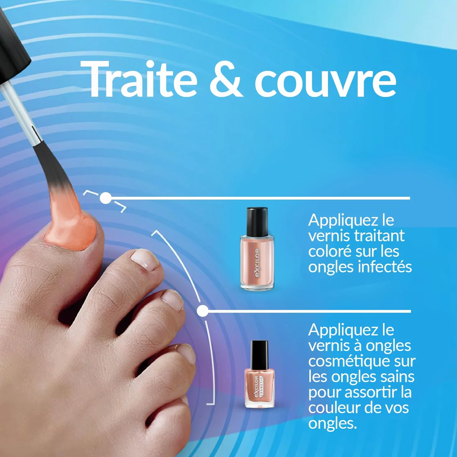 EXCILOR - Forte Color - Trattamento della micosi dell'unghia - Tratta e copre - Trattamento 30 ml + Smalto cosmetico per unghie da 8 ml - Clinicamente provato* - Nude