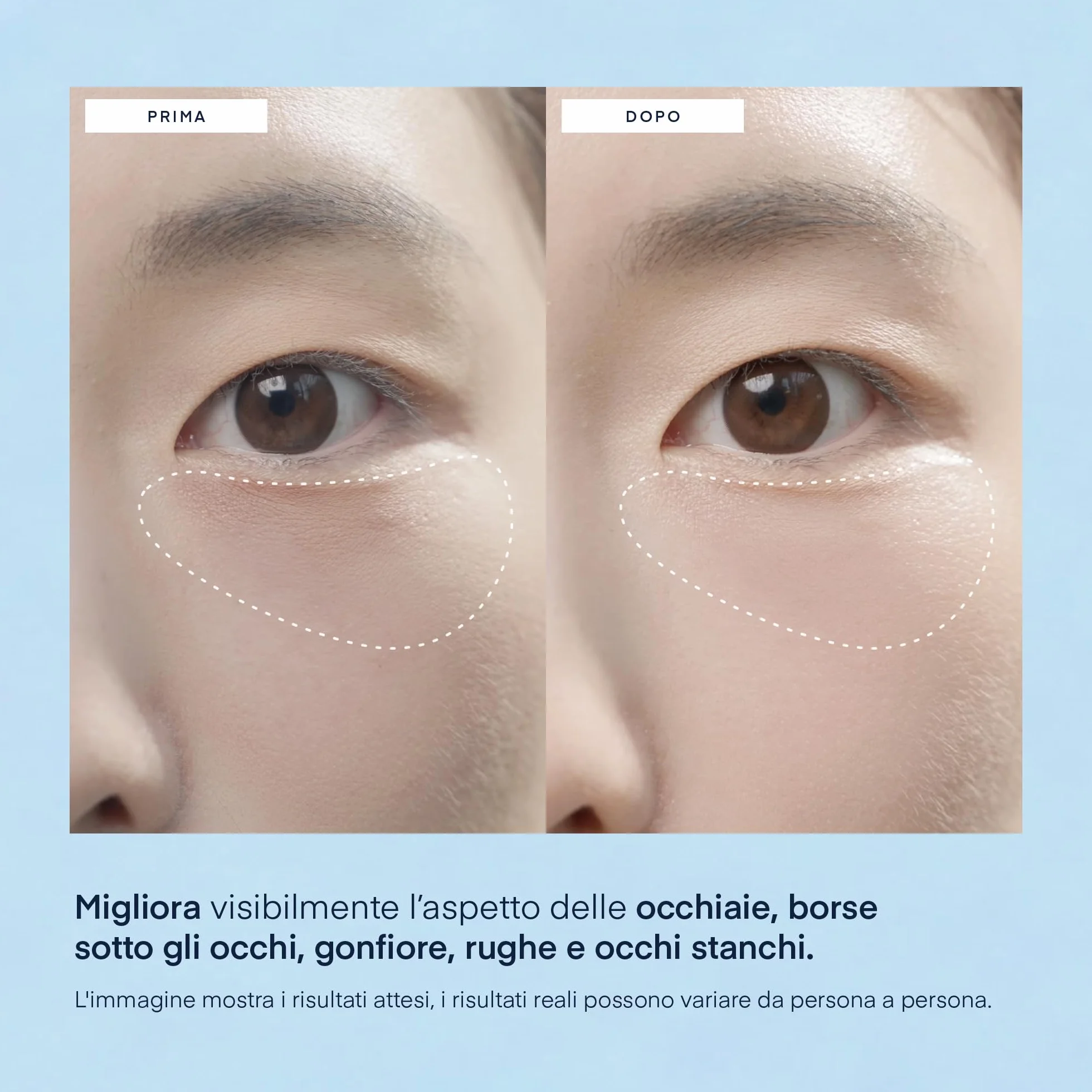 Patch Occhi per Occhiaie Skincare Coreana: Maschera Contorno Occhi con Caffeina e Acido Ialuronico - Sgonfia Borse & Antirughe 30 Paia - Vegano, Testato su Pelle Sensibile - Korean Under Eye Patches