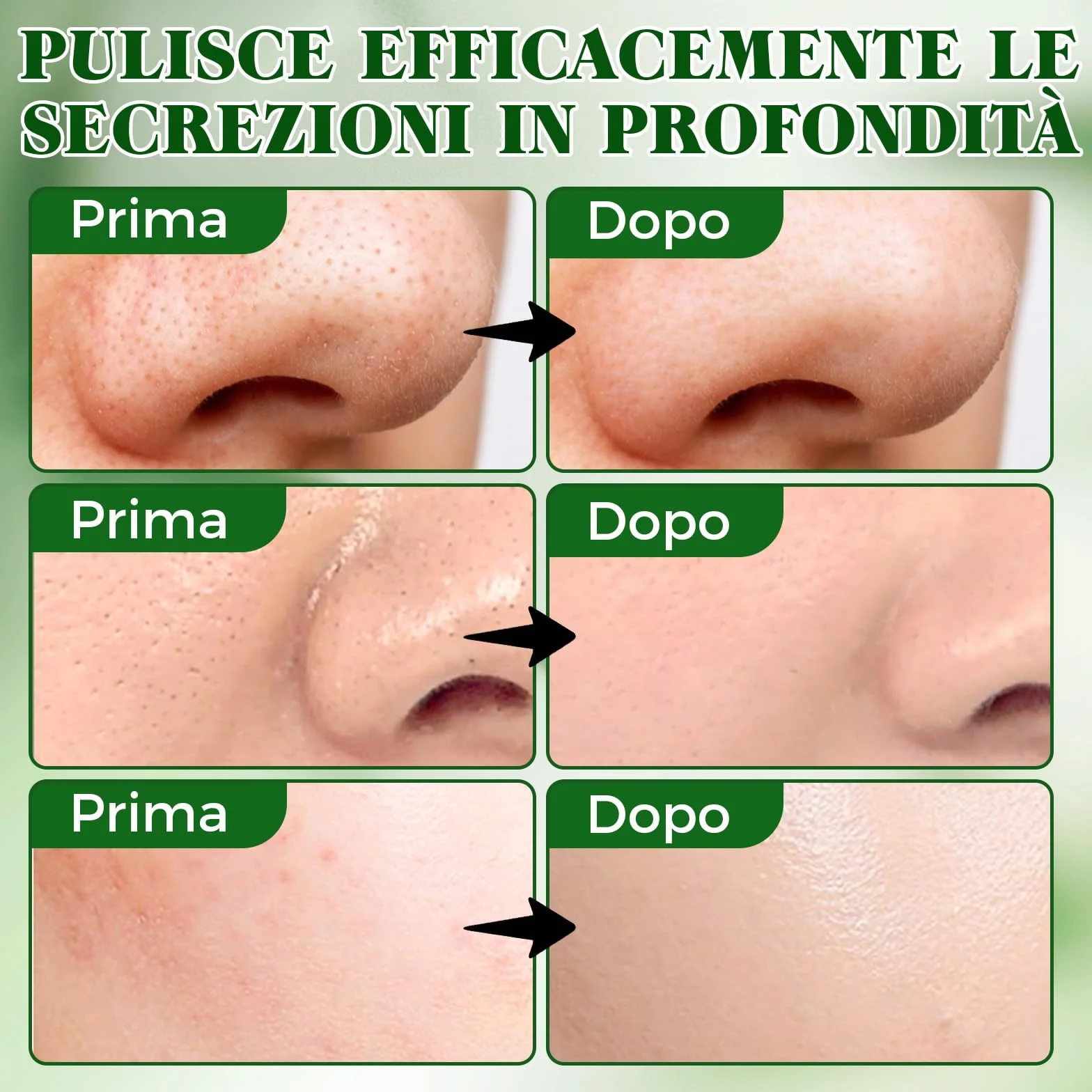 Punti Neri Rimozione, 80pcs Carbone Cerotti Togli Punti Neri Naso per Una Pulizia Profonda, Liberando i Pori, Efficace e Delicata Nose Strips per Tutti i Tipi di Pelle
