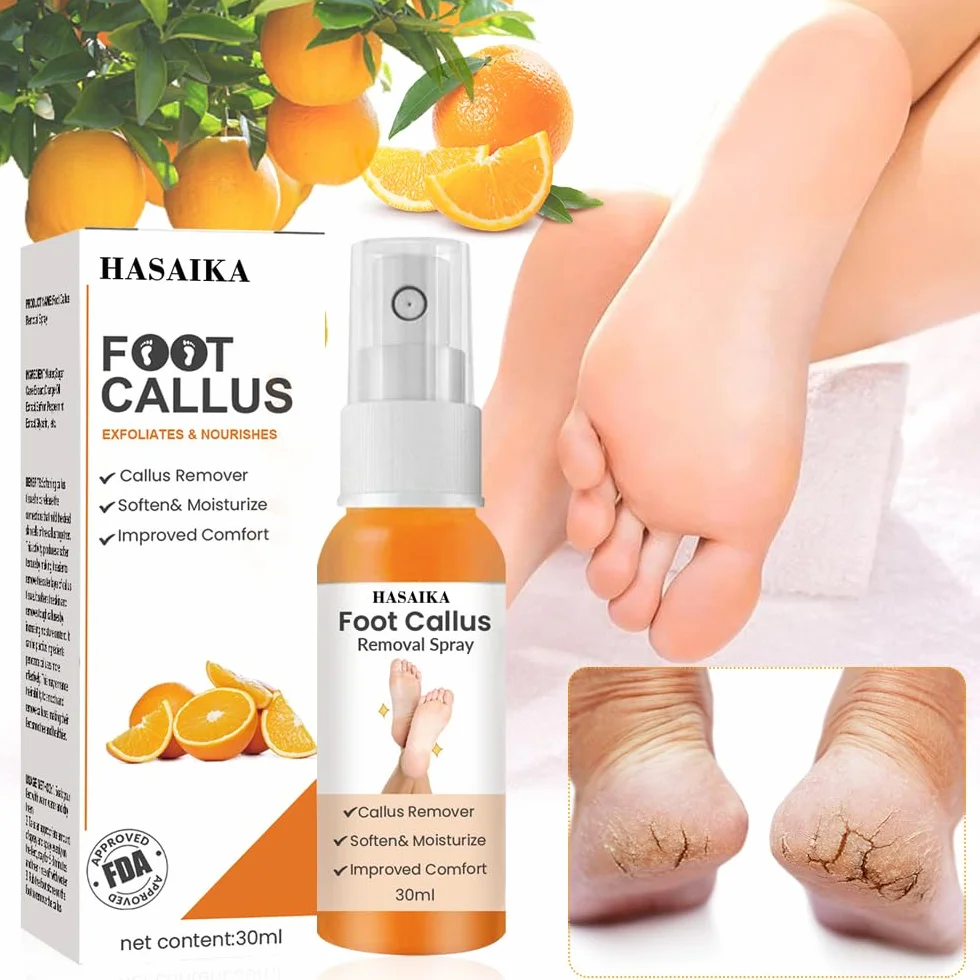 Spray per la Rimozione del Callo del Piede, Spray per il Peeling del Piede, Spray per Rimuovere i Calli dei Piedi,per Talloni Ruvidi e Screpolati, Pelle Secca e Calli