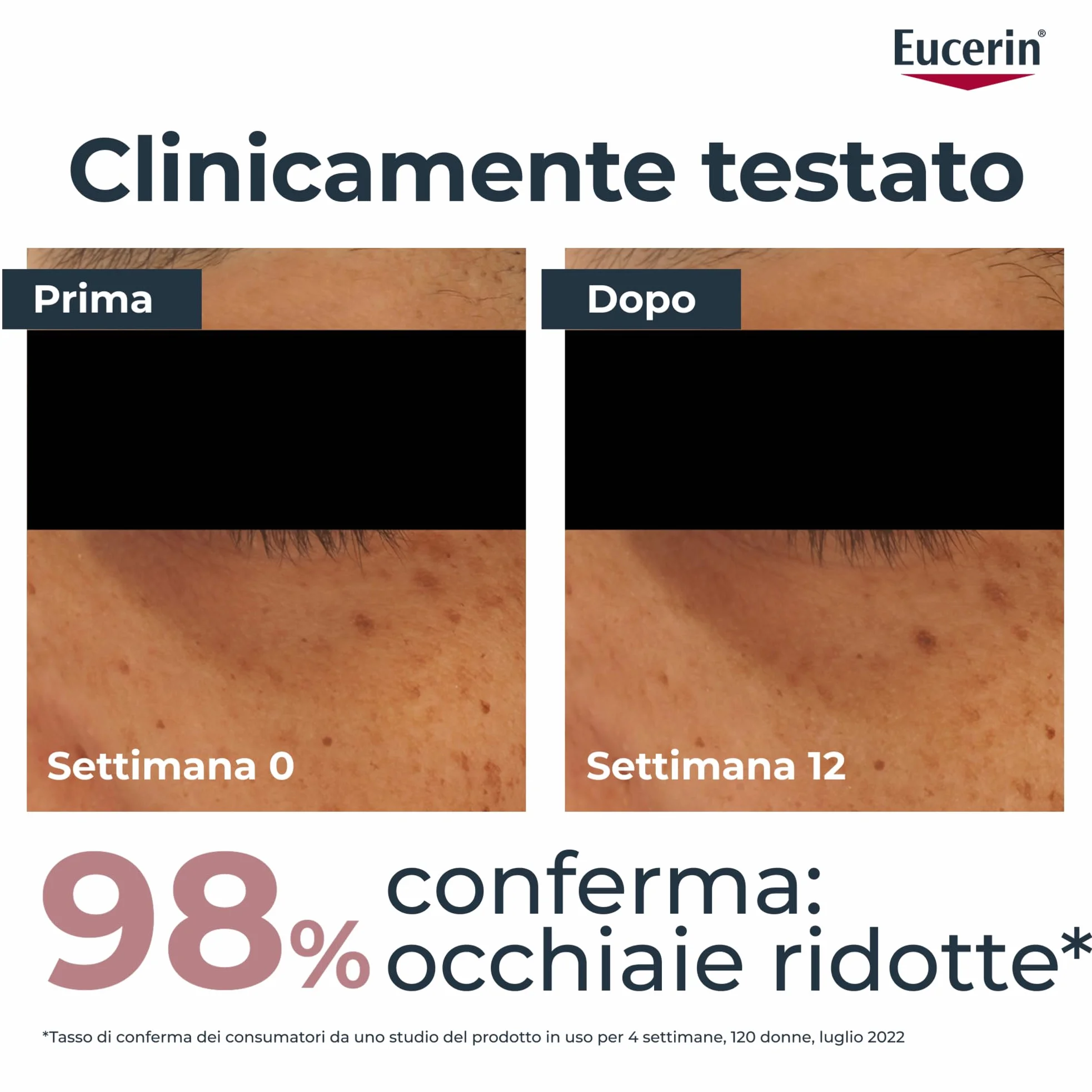 Eucerin Anti-Pigment Contorno Occhi Illuminante Correttore Occhiaie 15 ml, Crema contorno occhi per uno sguardo luminoso, Crema occhiaie brune e bluastre arricchita con Acido Ialuronico