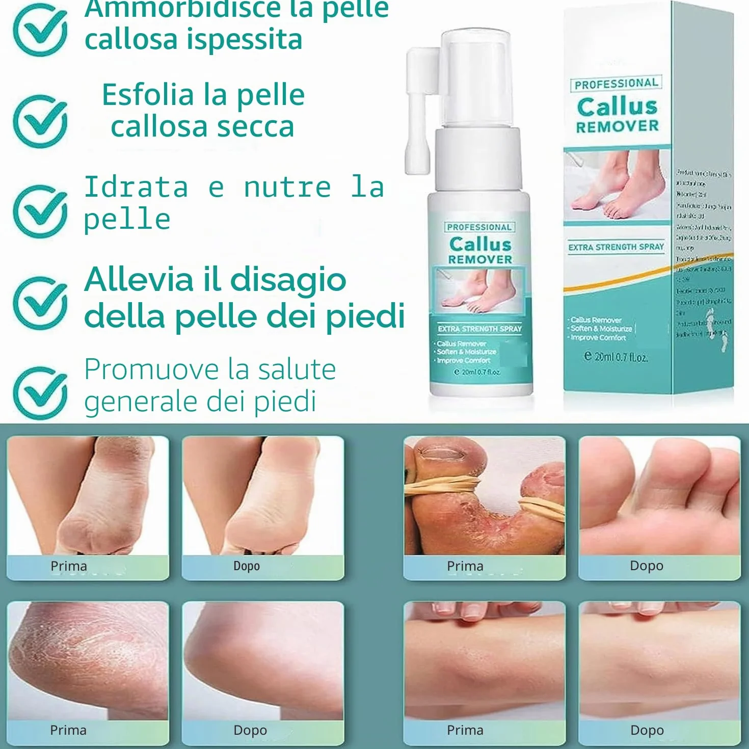 Spray extra forte per rimuovere i calli: spray rimuovi calli per piedi e tallone, olio spray per pelle morta