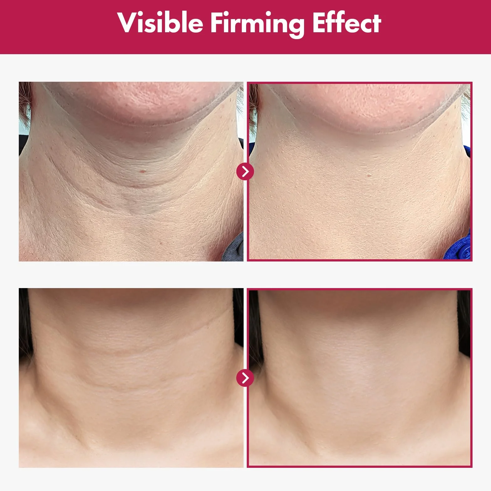 TOSOWOONG Collagen Necktox Crema con Collagene e Acido Ialuronico, Crema rassodante per il collo, per un aspetto più levigato e giovane, Skincare coreana, 50ml