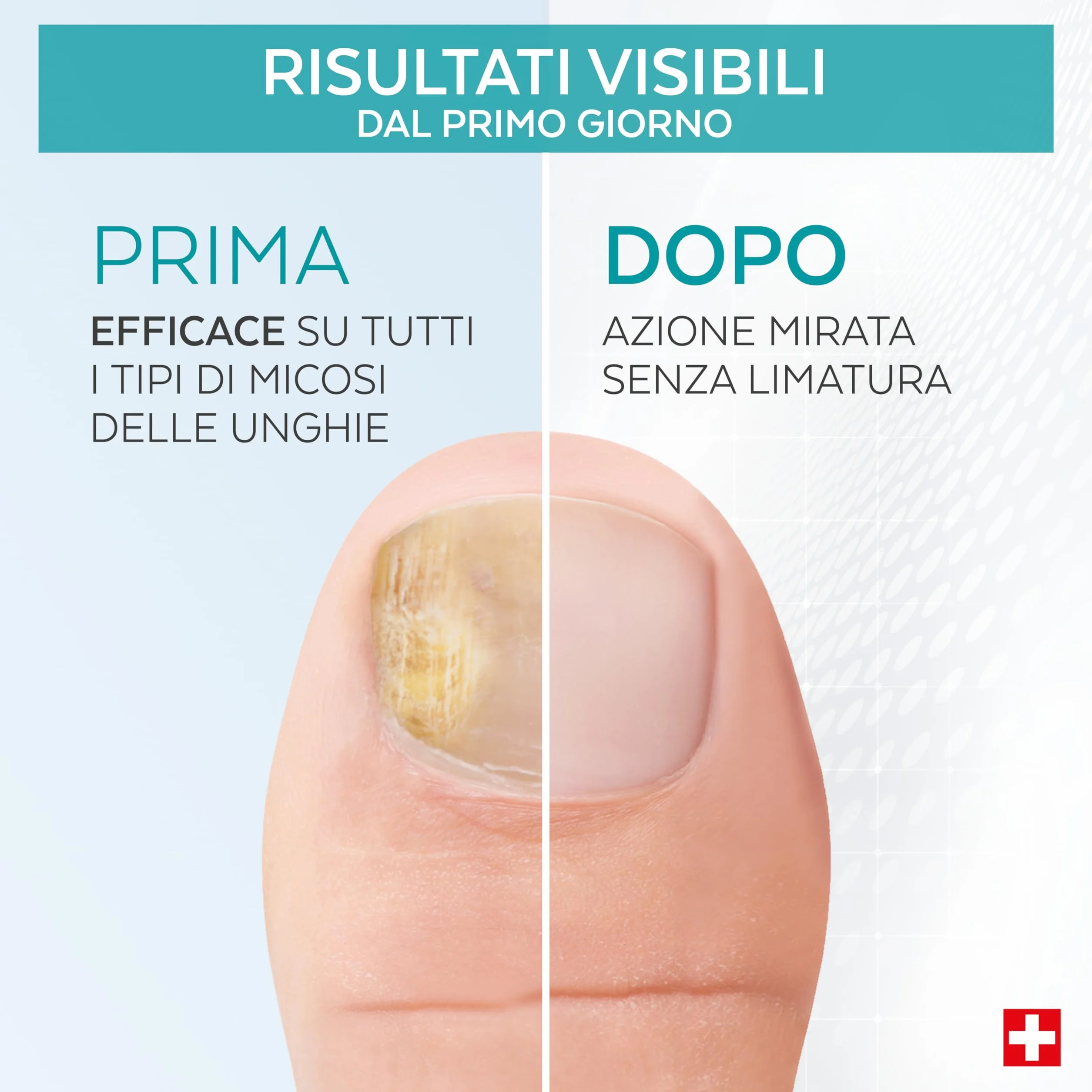 PODERM Trattamento Micosi Unghie Soluzione Naturale Unghie Fungus Alle Piante Potenti Riparatrici Purificanti Rivitalizzanti Mani Piedi Facile Rapido Prodotto in Svizzera