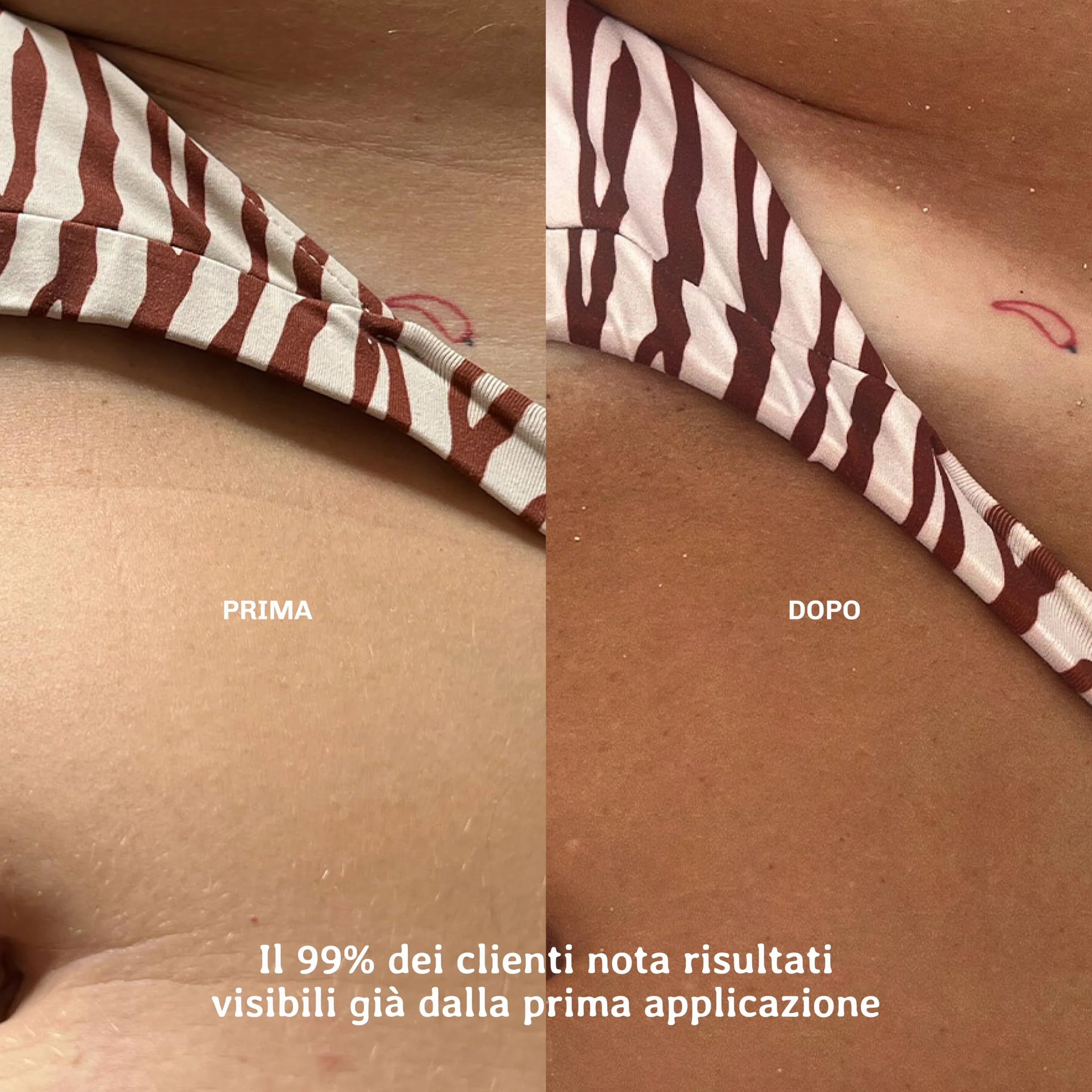 KREAM Fast Tan - Acceleratore Abbronzatura, Crema Corpo per Sole e Solarium, Attiva la Melanina + Idratazione Profonda, Abbronzatura Rapida e Naturale, Senza Filtri UV, 150 ml